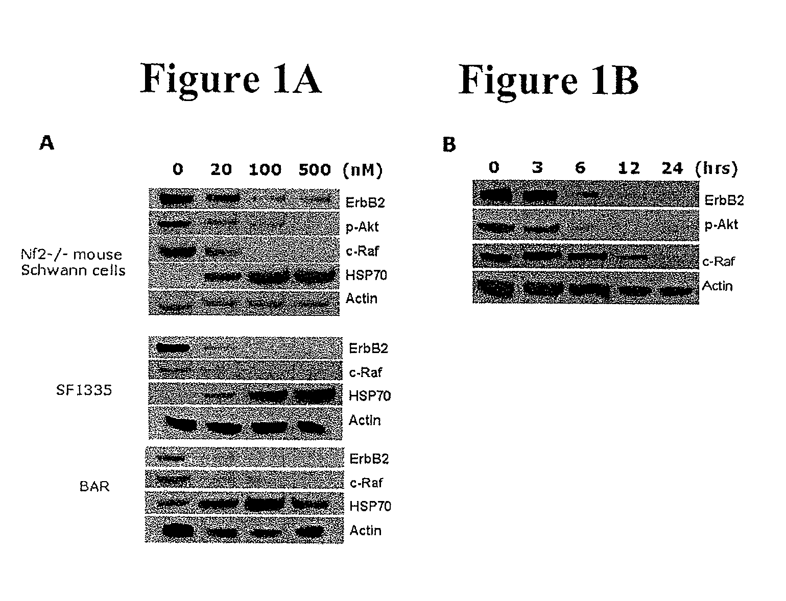 Treatment of neurofibromatosis with radicicol and its derivatives