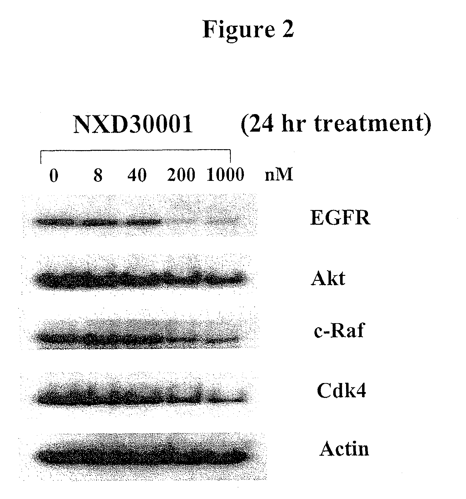 Treatment of neurofibromatosis with radicicol and its derivatives