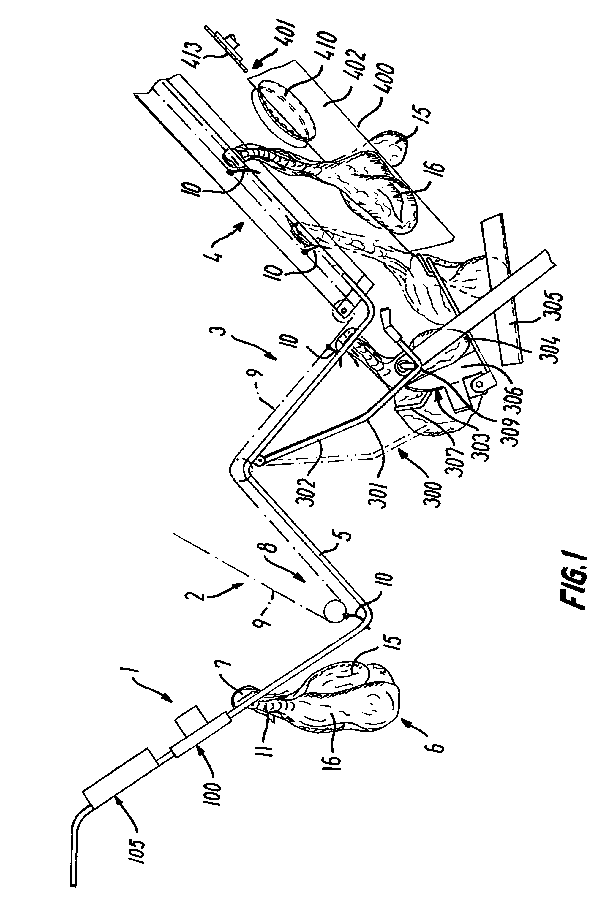 Apparatus and a method for automatic cutting of organs from a plucks set from a carcass