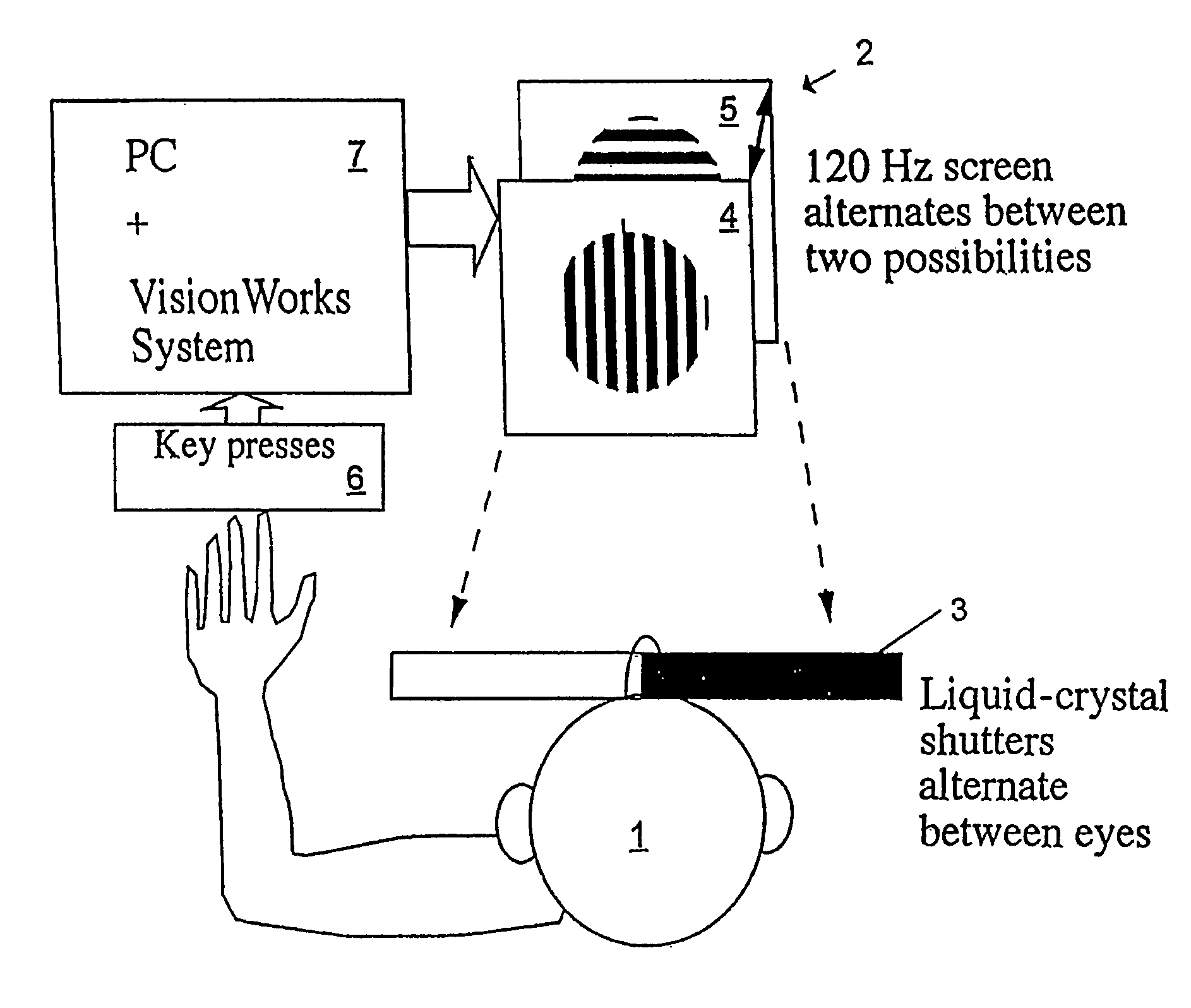 Method and apparatus for diagnosing schizophrenia and schizophrenia subtype