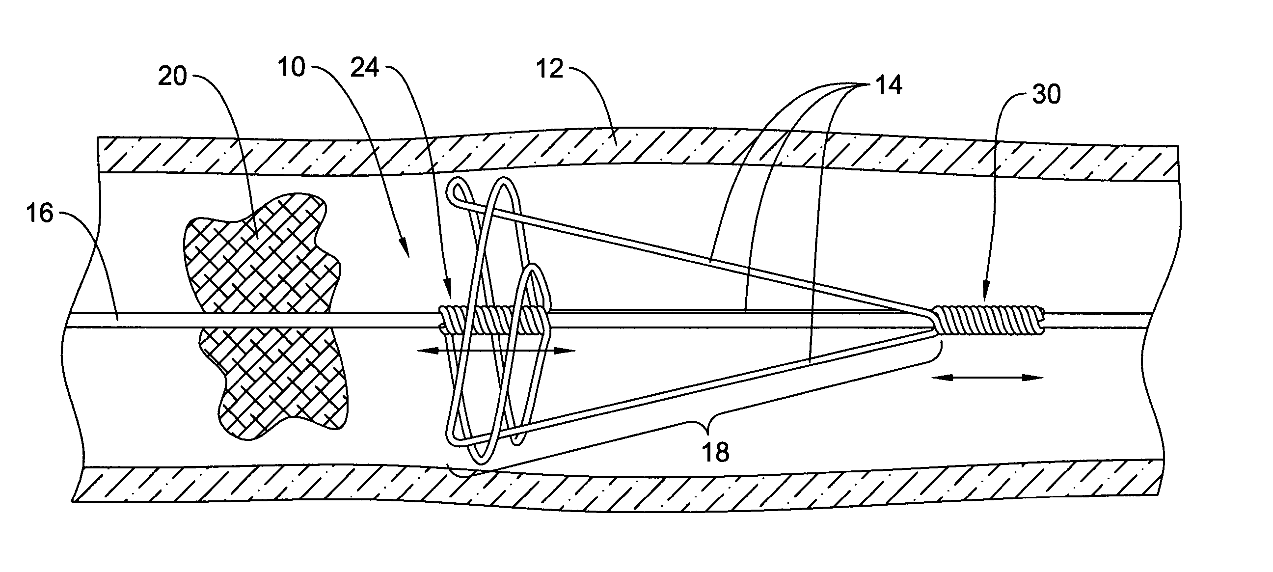 Clot removal device