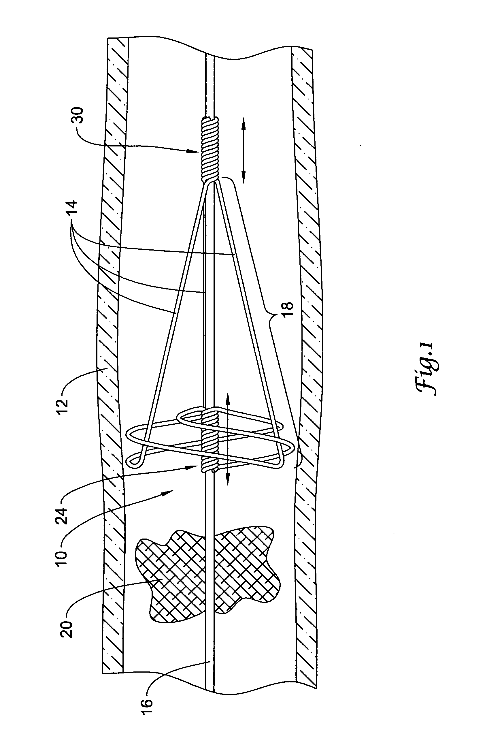 Clot removal device