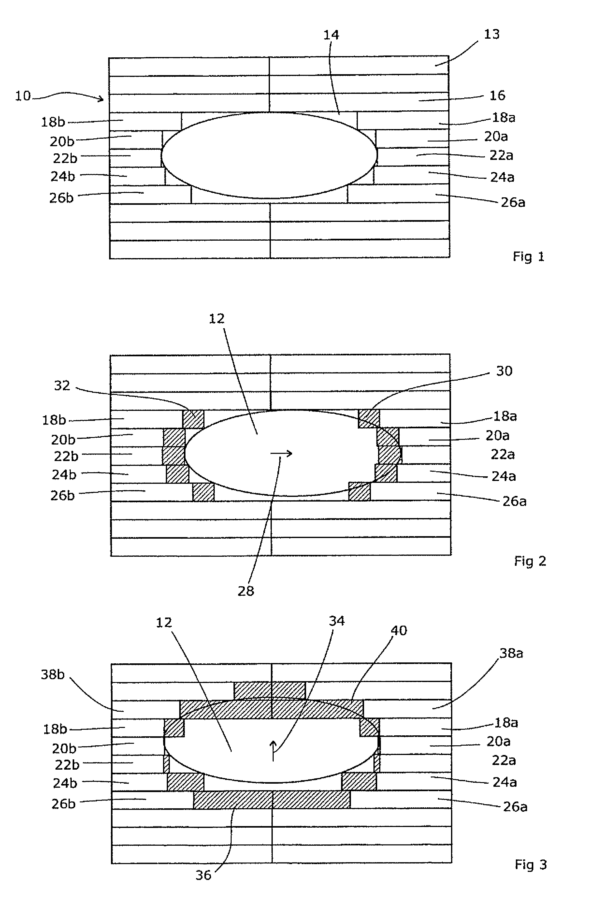 Radiotherapy apparatus