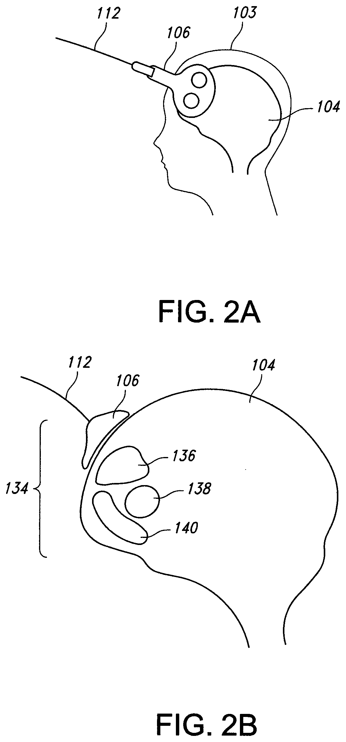 Transcranial Magnetic Stimulation for the Treatment of Dysautonomia