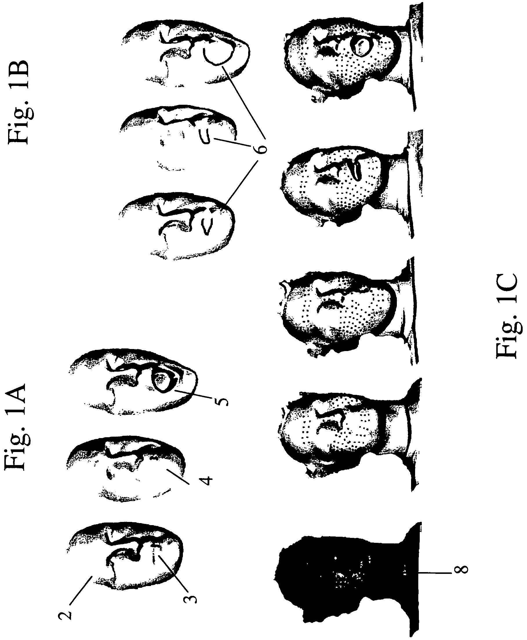 Facial recognition and the open mouth problem