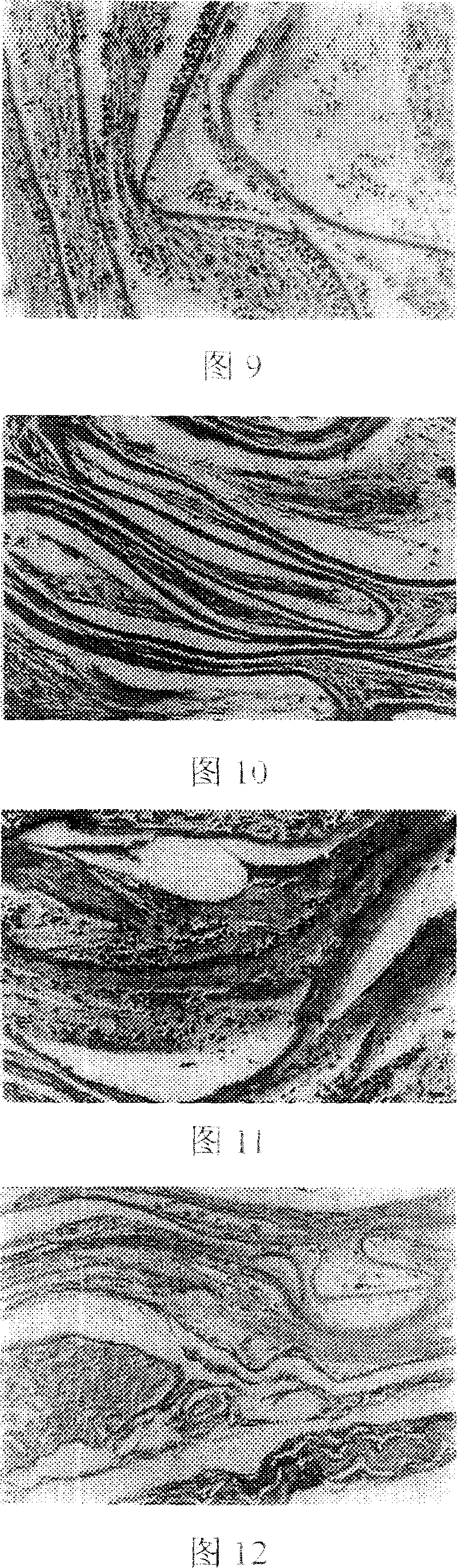 Bioderived amnion, composite bioderived amnion and its preparation method