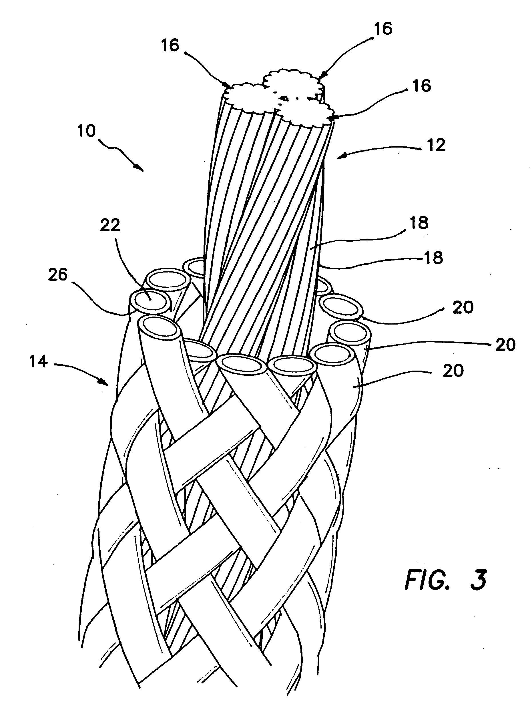 Optimized suture braid