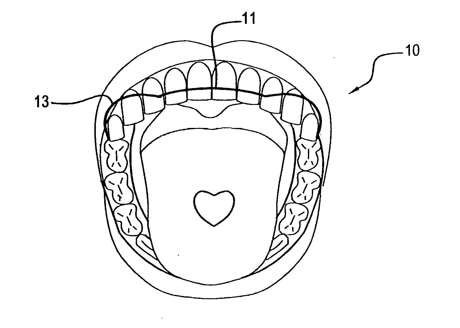 Illuminated orthodontic retainer and case therefor