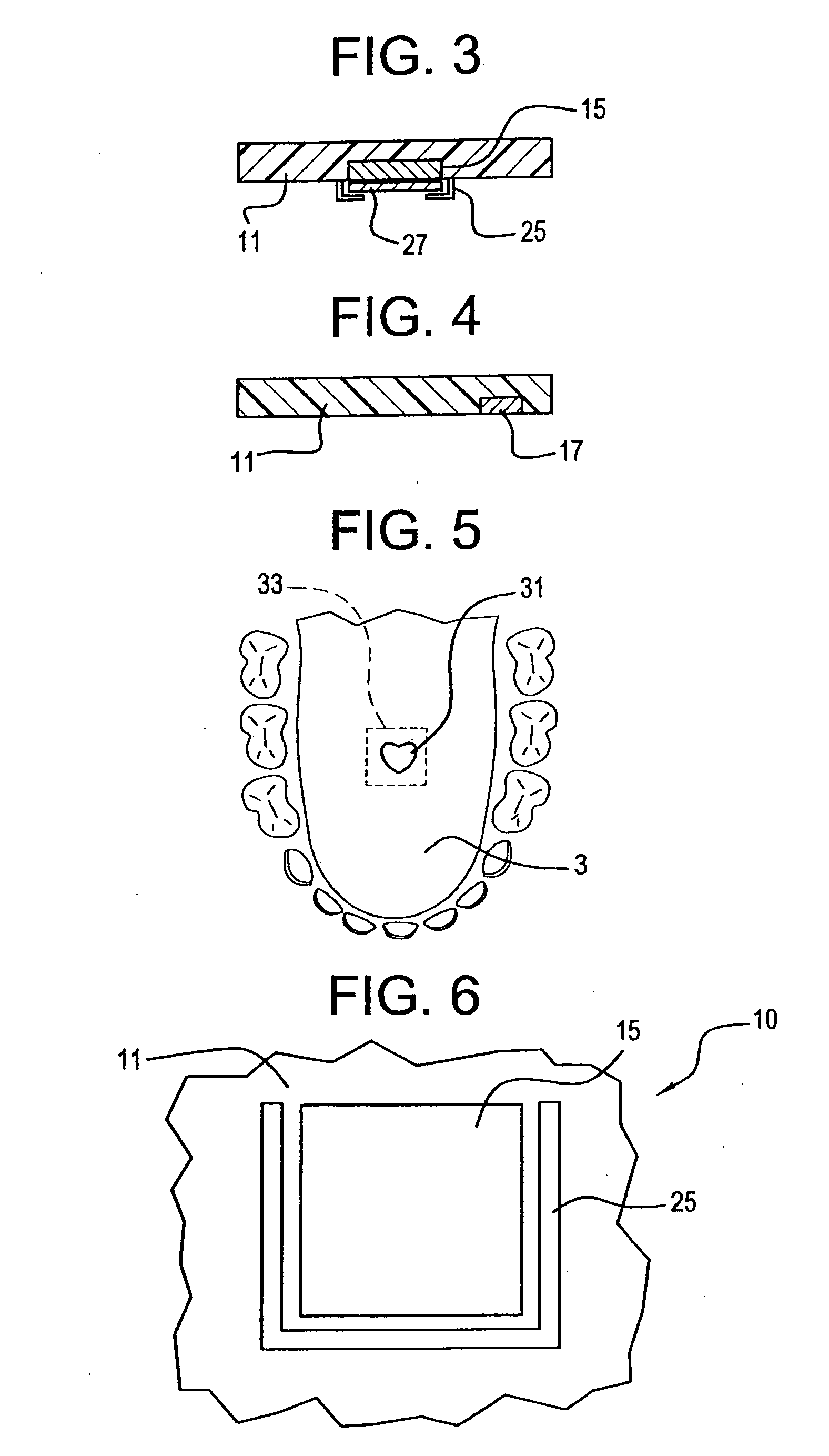 Illuminated orthodontic retainer and case therefor