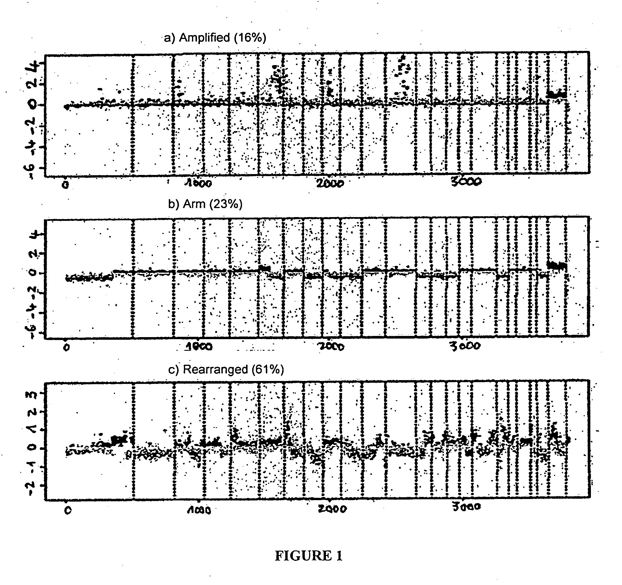 Prognostic molecular signature of sarcomas, and uses thereof