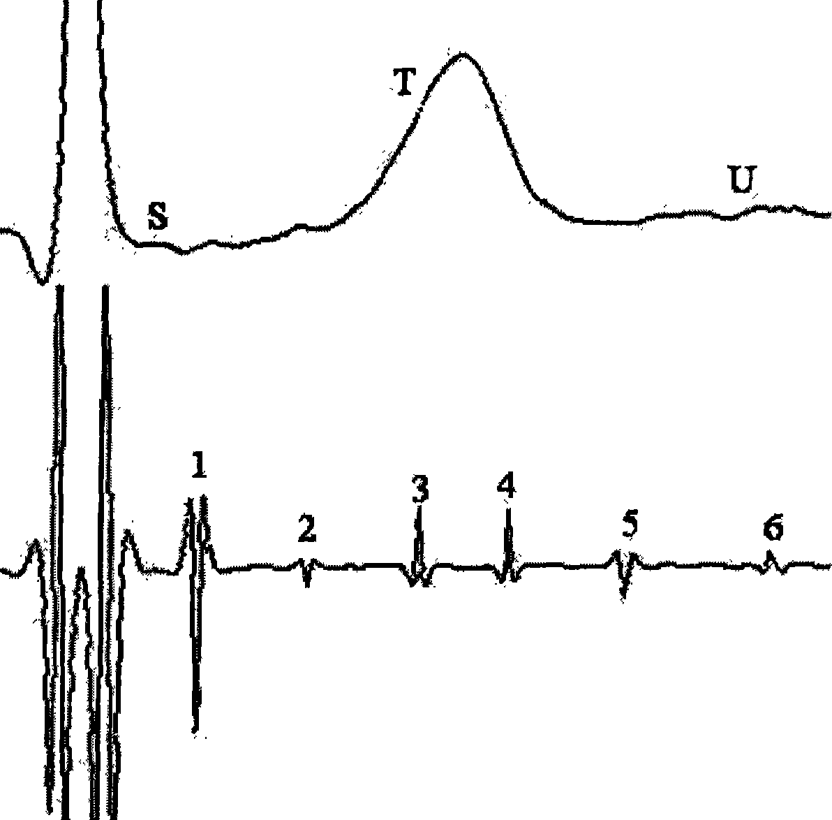 Body surface detection method and device for high frequency wave of repolarization of ventricle