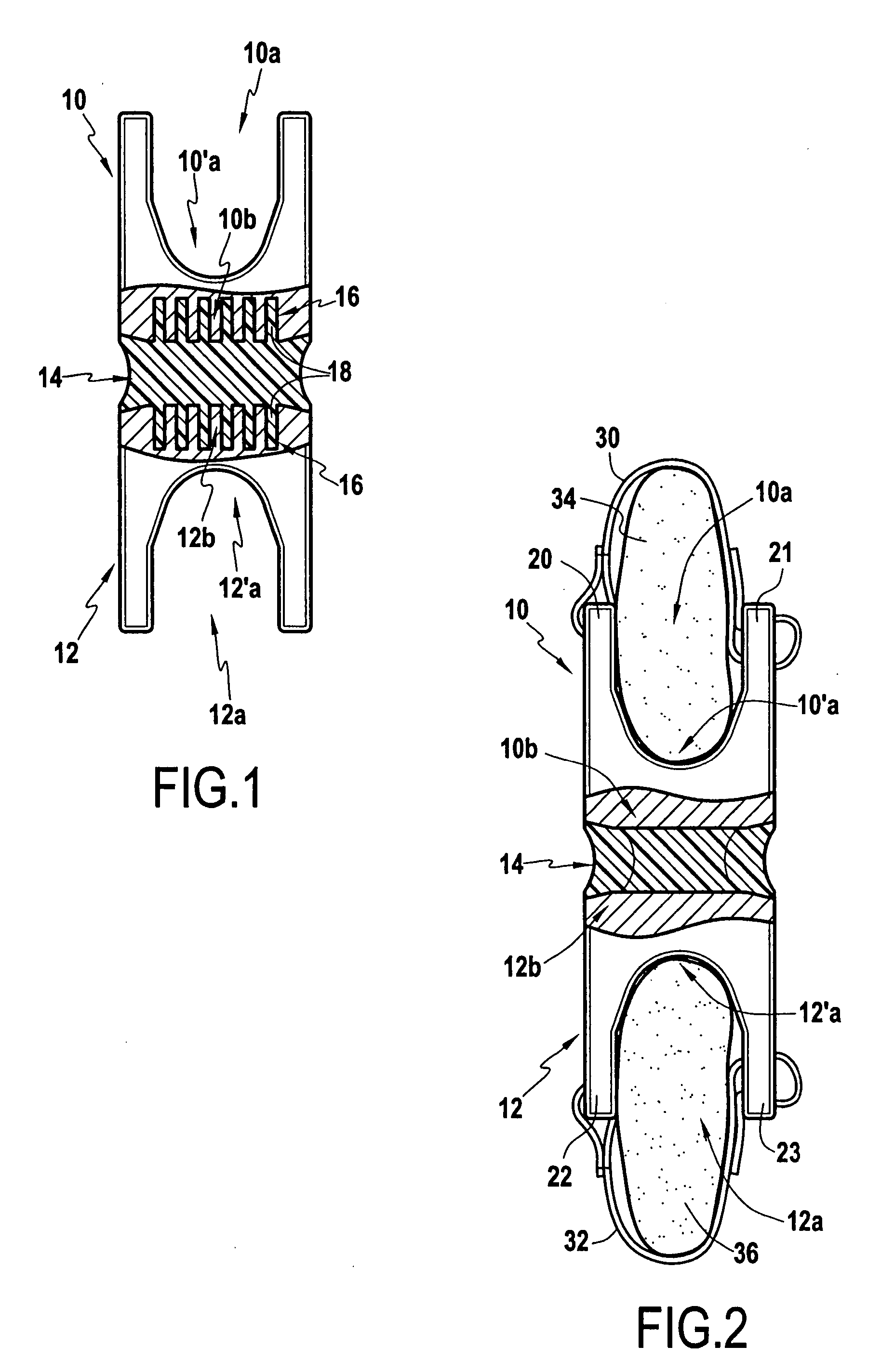 Shock-absorbing intervertebral implant