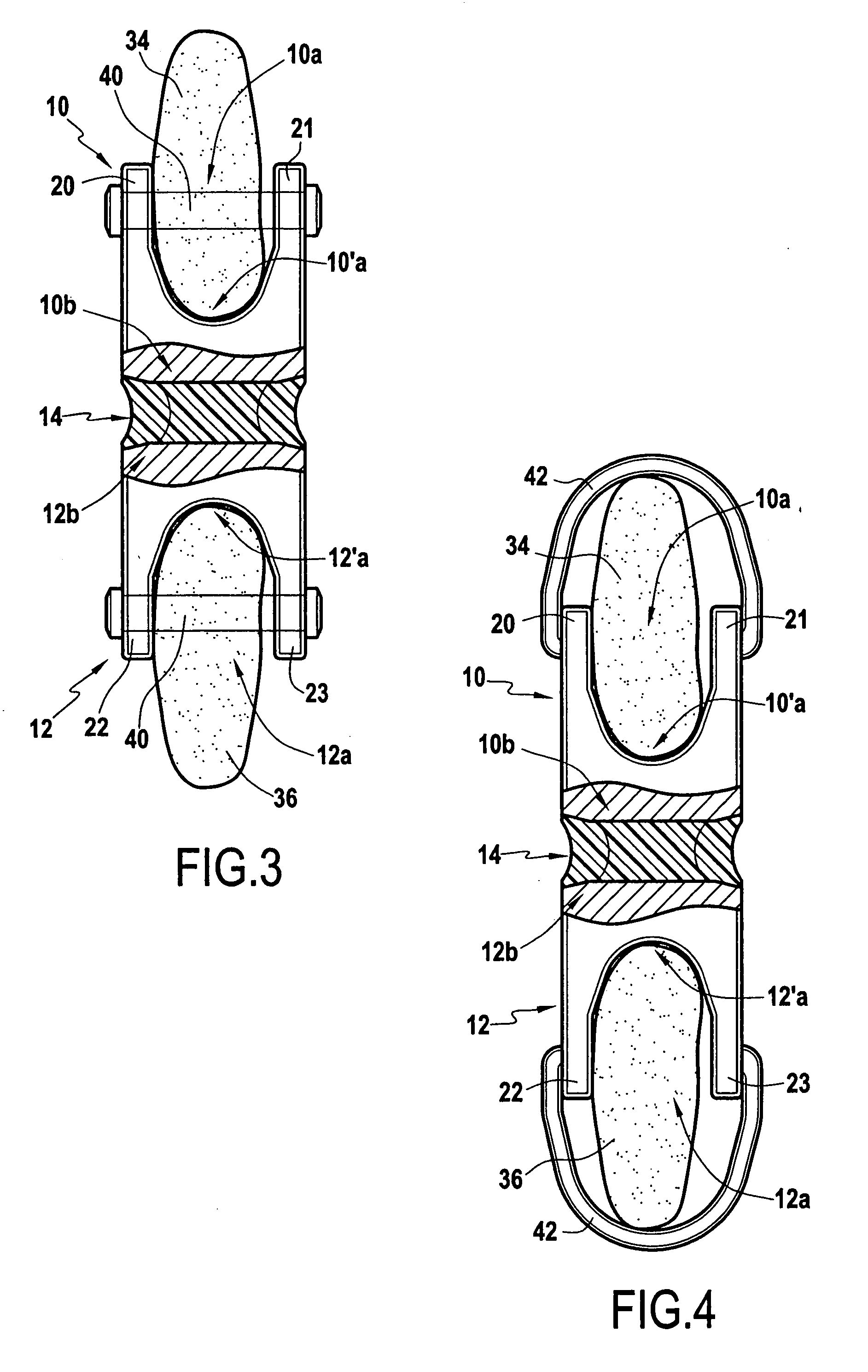 Shock-absorbing intervertebral implant