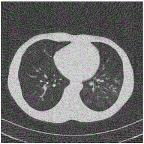 Low-dose CT image statistical reconstruction method based on discrete shear wave regularization