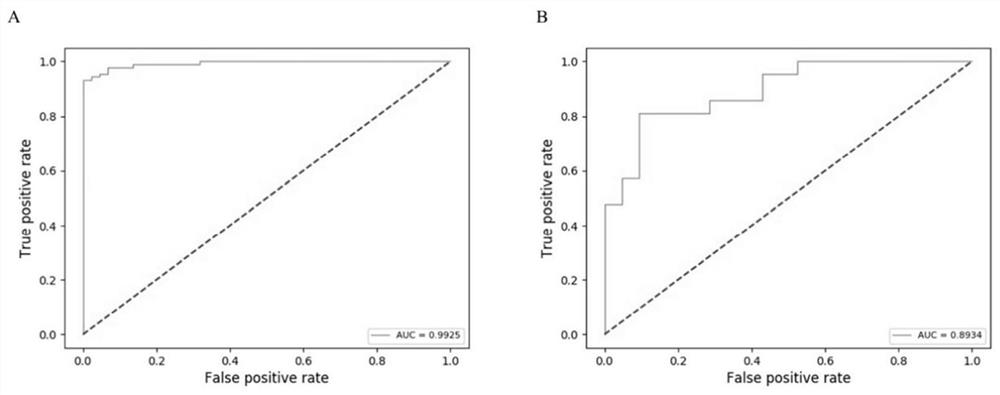 Enhanced CT (Computed Tomography) imageomics feature processing method for upper abdomen of liver cirrhosis patient and application thereof