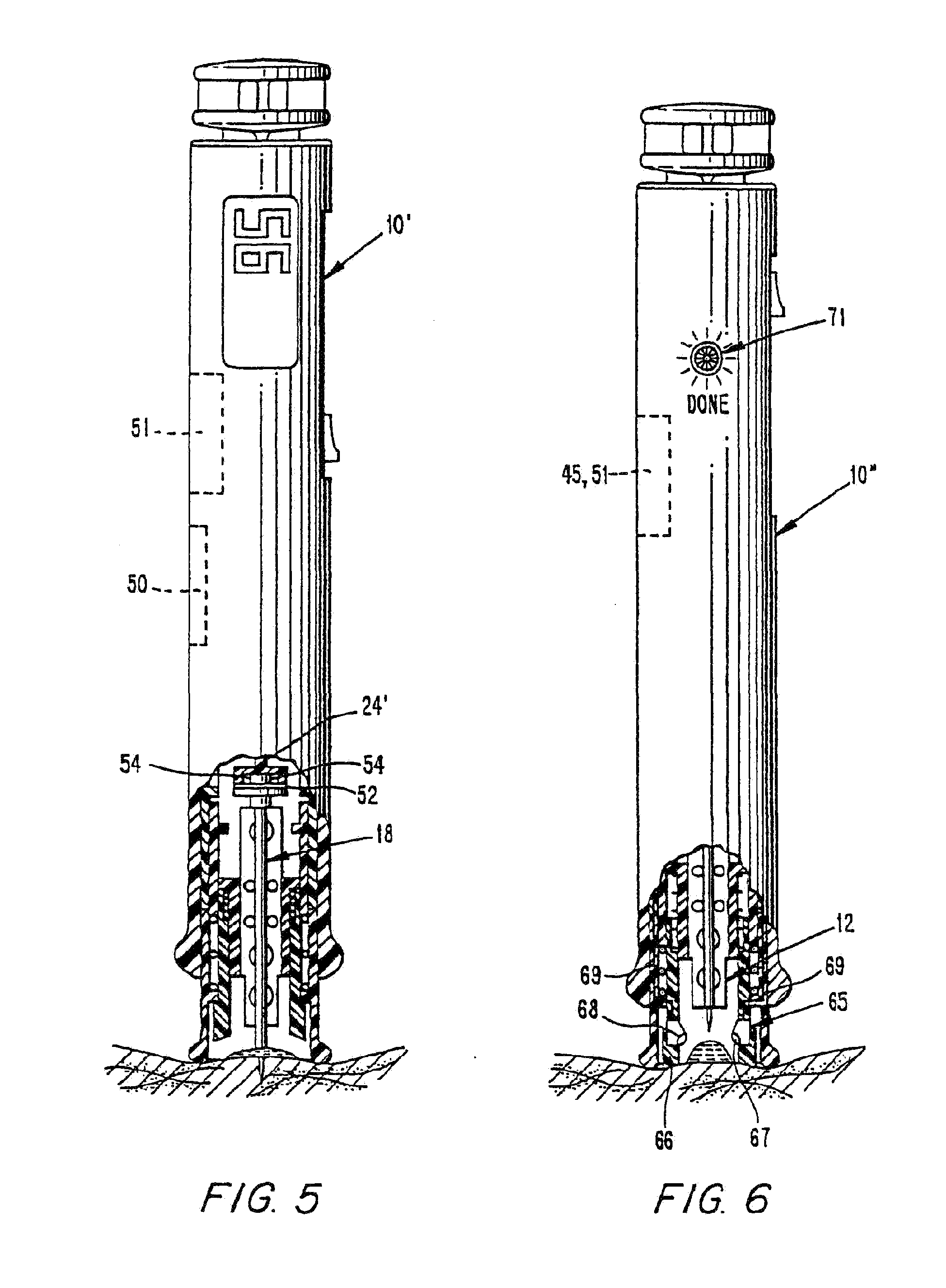 Methods and apparatus for sampling and analyzing body fluid