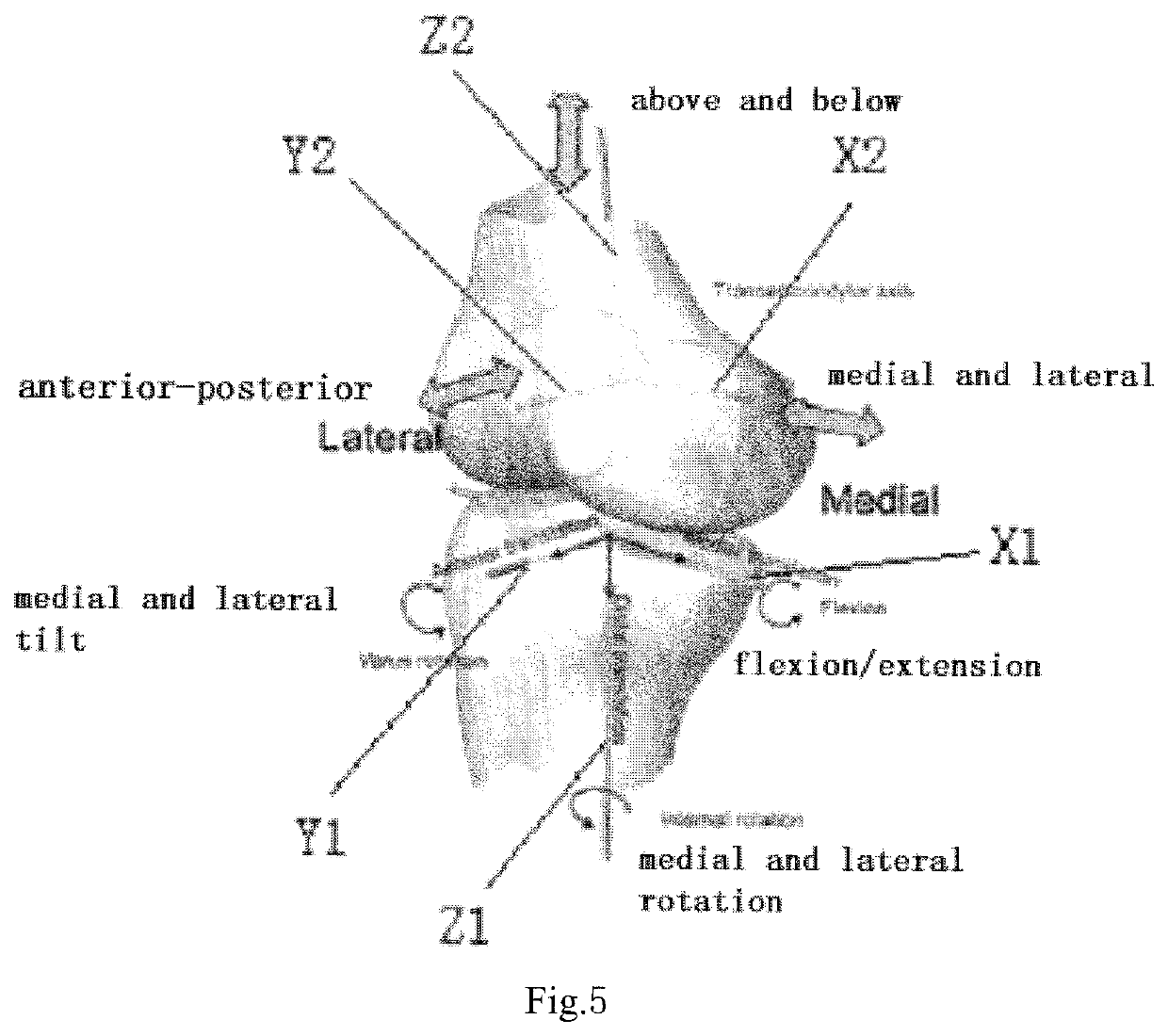 Joint movement analysis system and method; knee-joint dynamic evaluation method and system