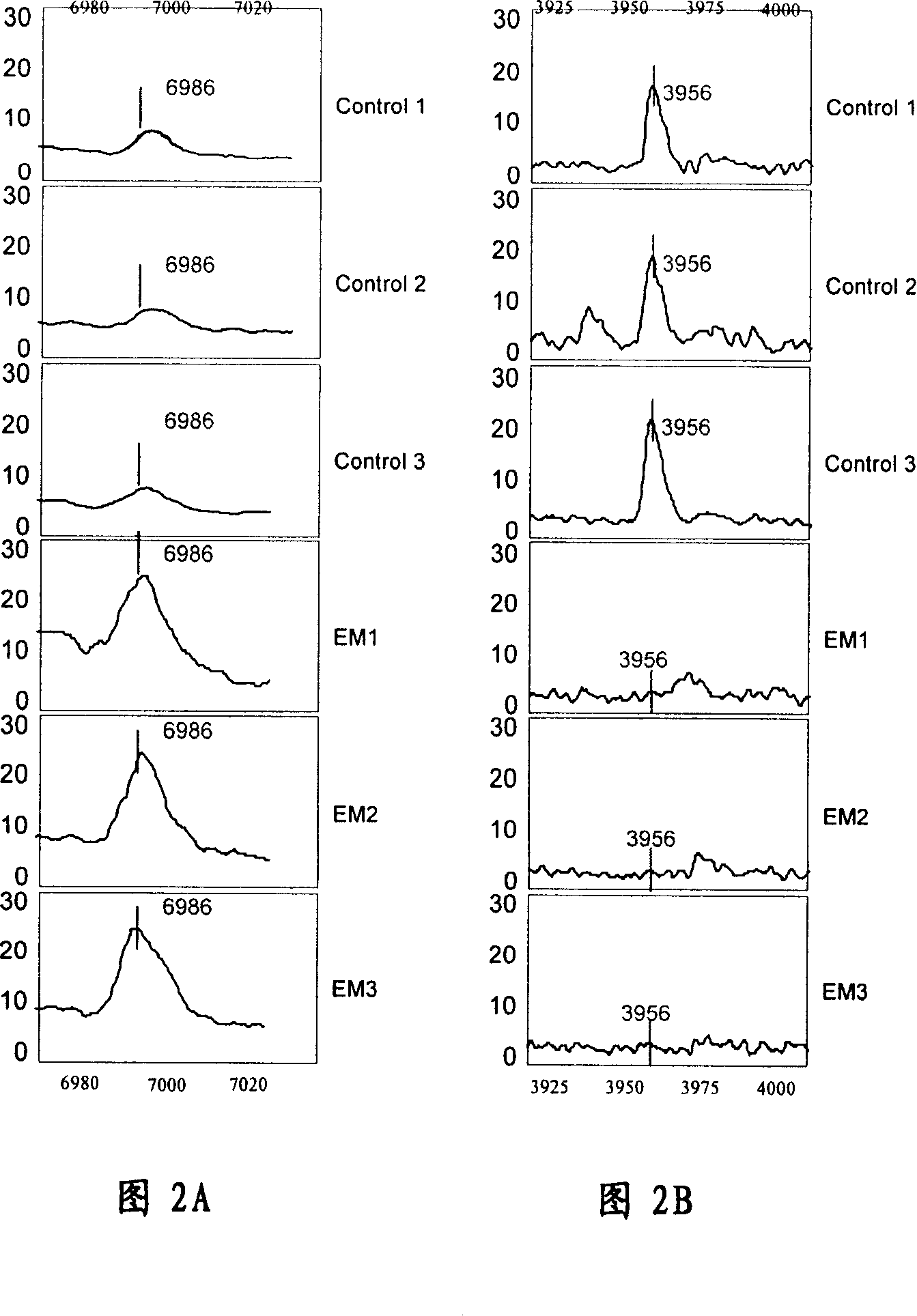 Method for detecting endometriosis blood plasma marker protein