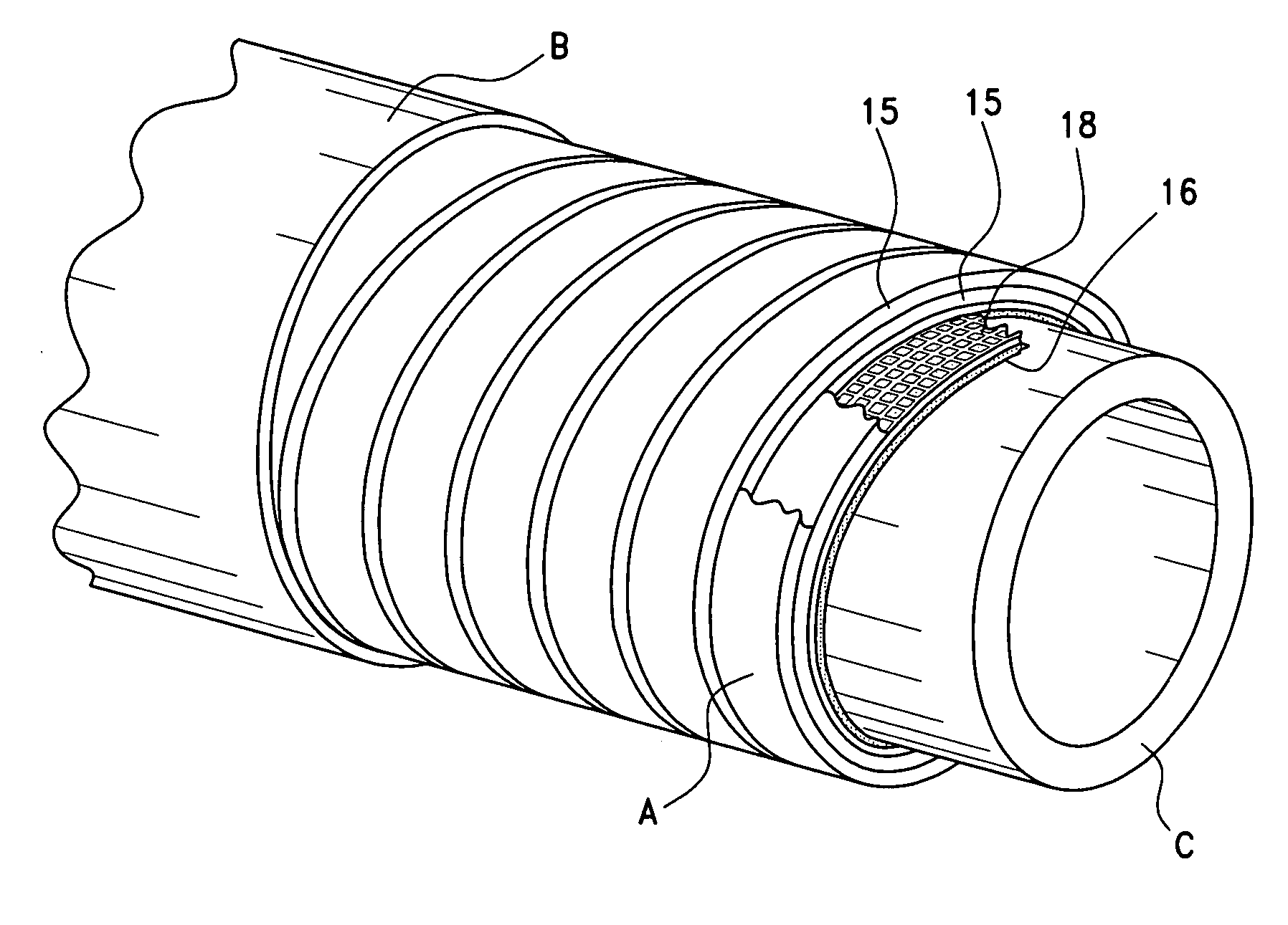 Anti-collapse system and method of manufacture