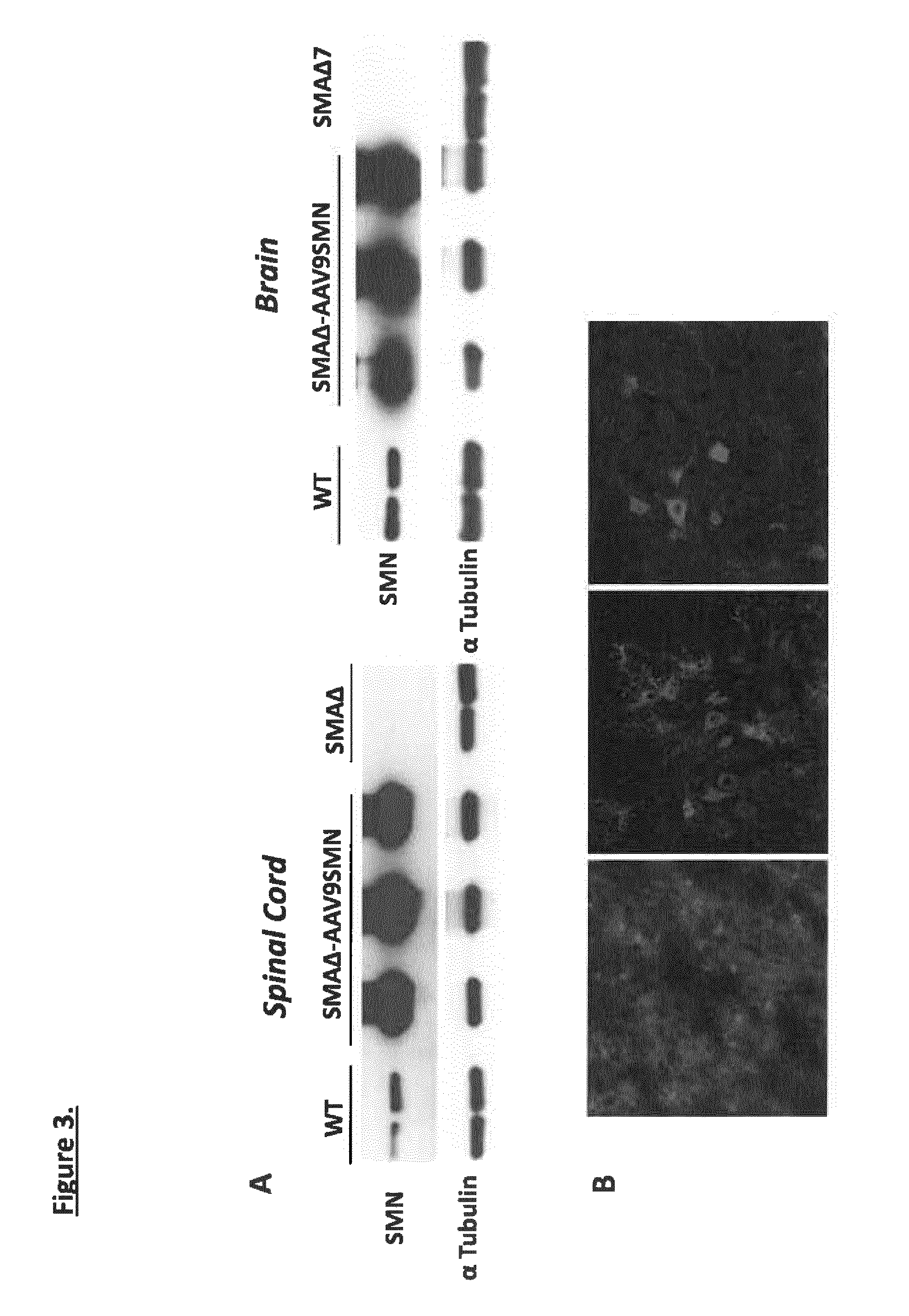 Widespread gene delivery of gene therapy vectors