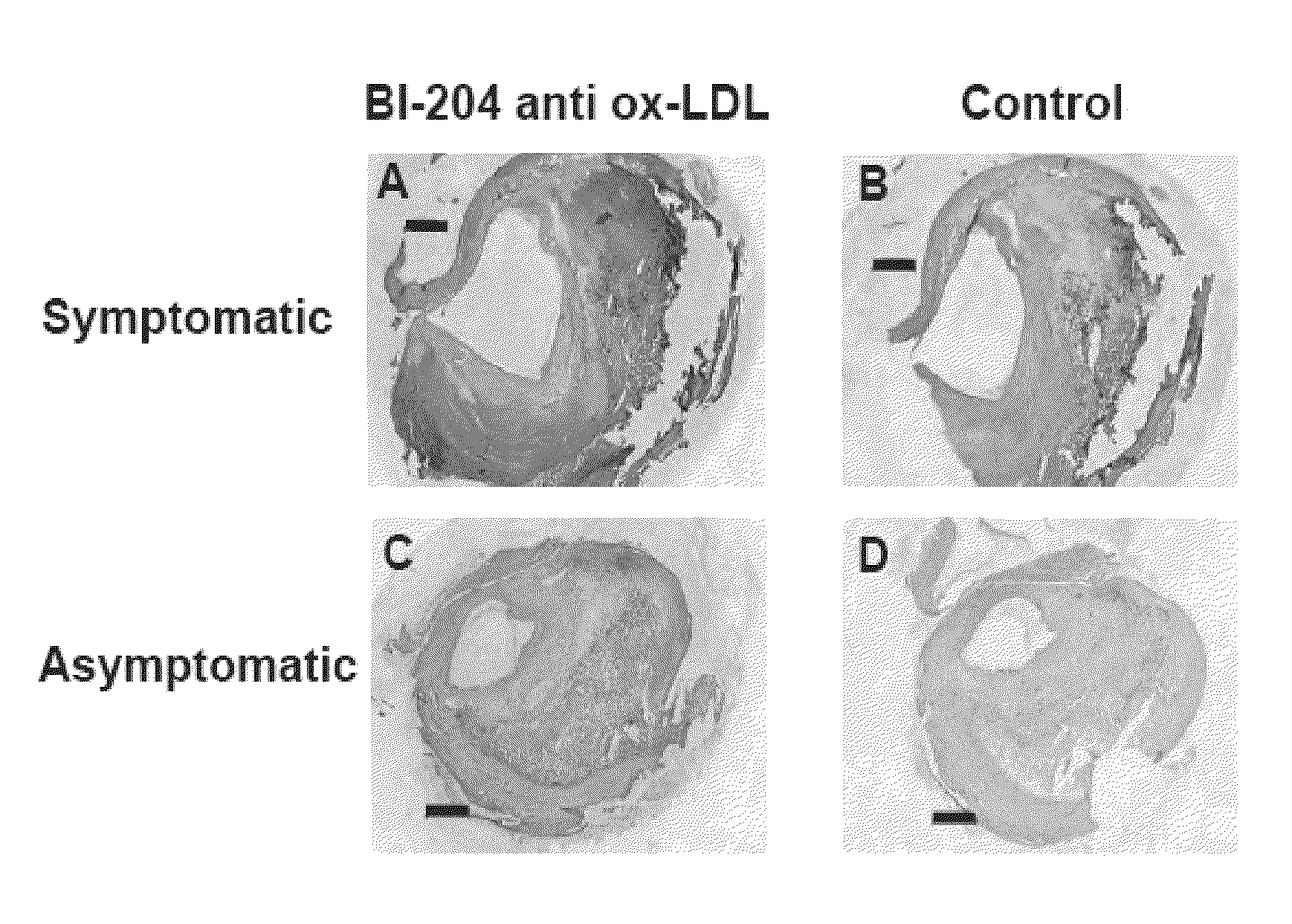 Oxidized ldl specific antibody-fusion and conjugated proteins