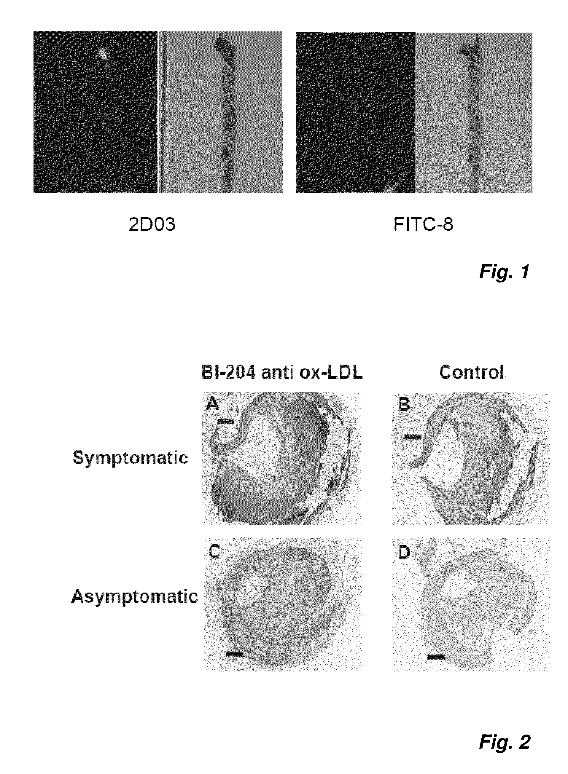 Oxidized ldl specific antibody-fusion and conjugated proteins