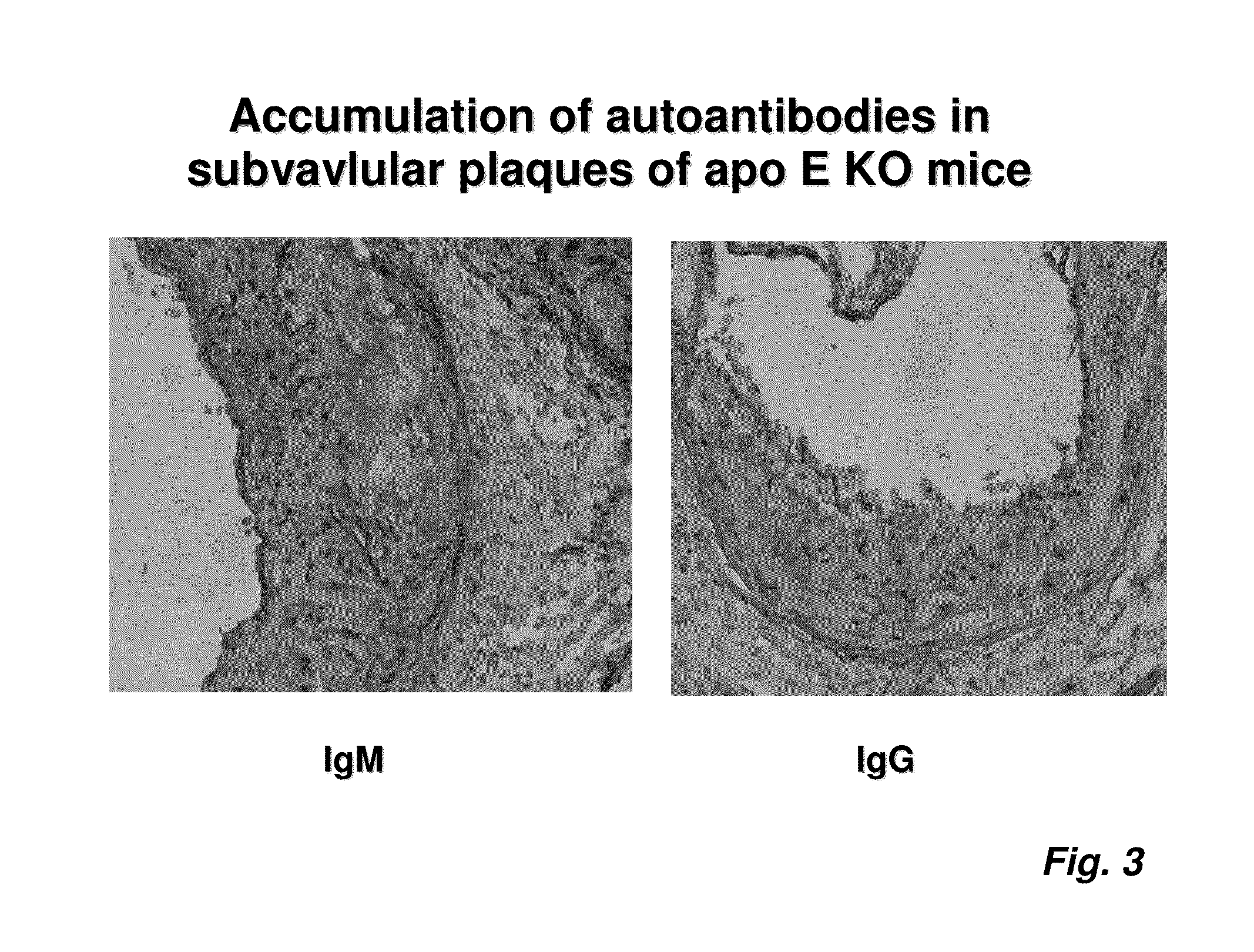 Oxidized ldl specific antibody-fusion and conjugated proteins