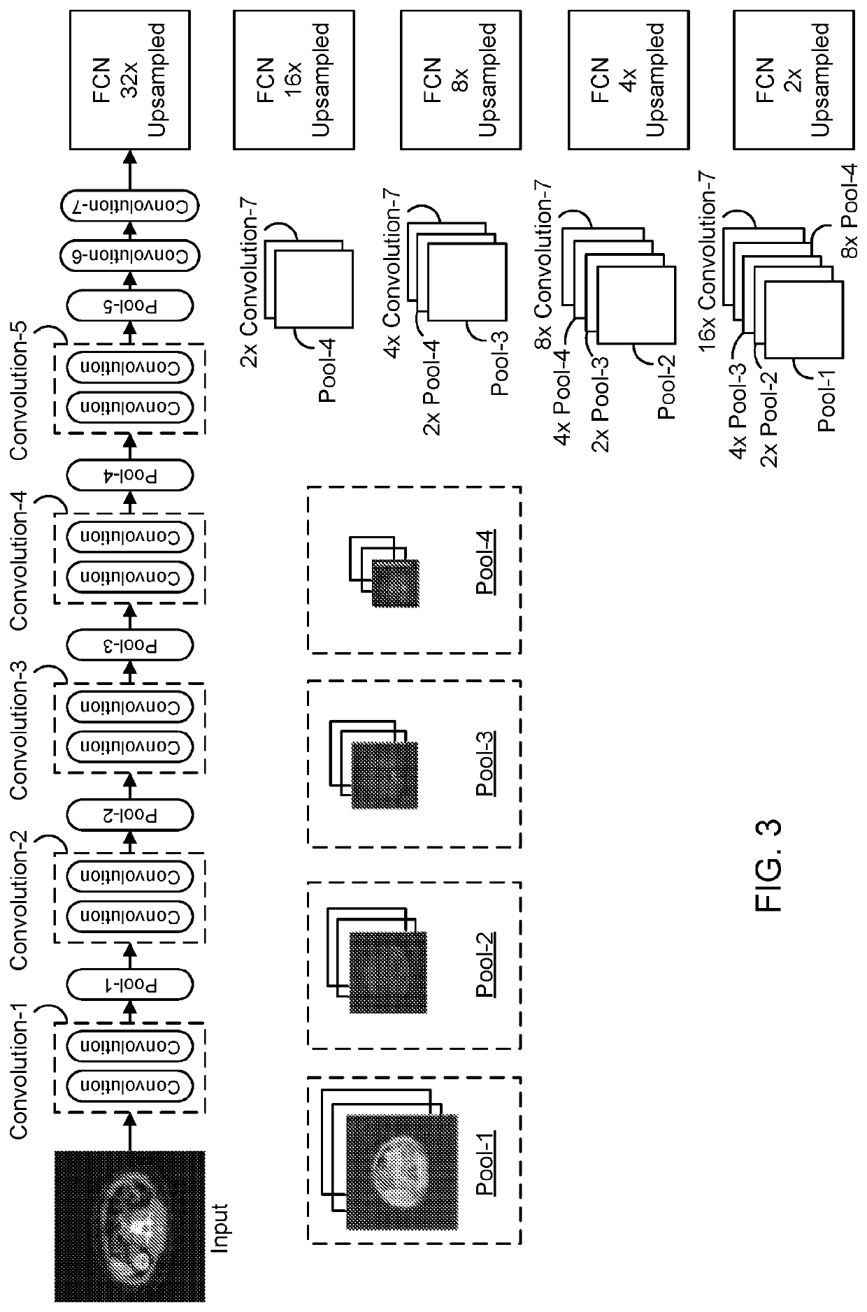 Patient risk stratification based on body composition derived from computed tomography images using machine learning