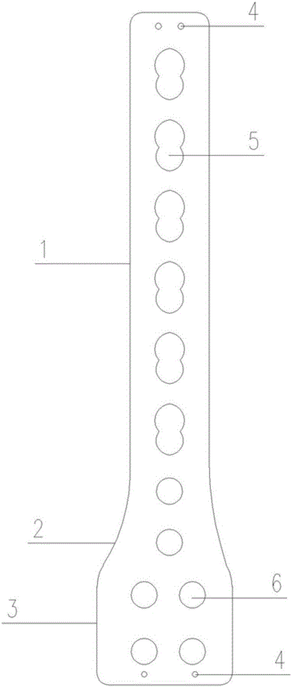 Novel middle-inferior humerus anterior-lateral anatomy locking bone plate