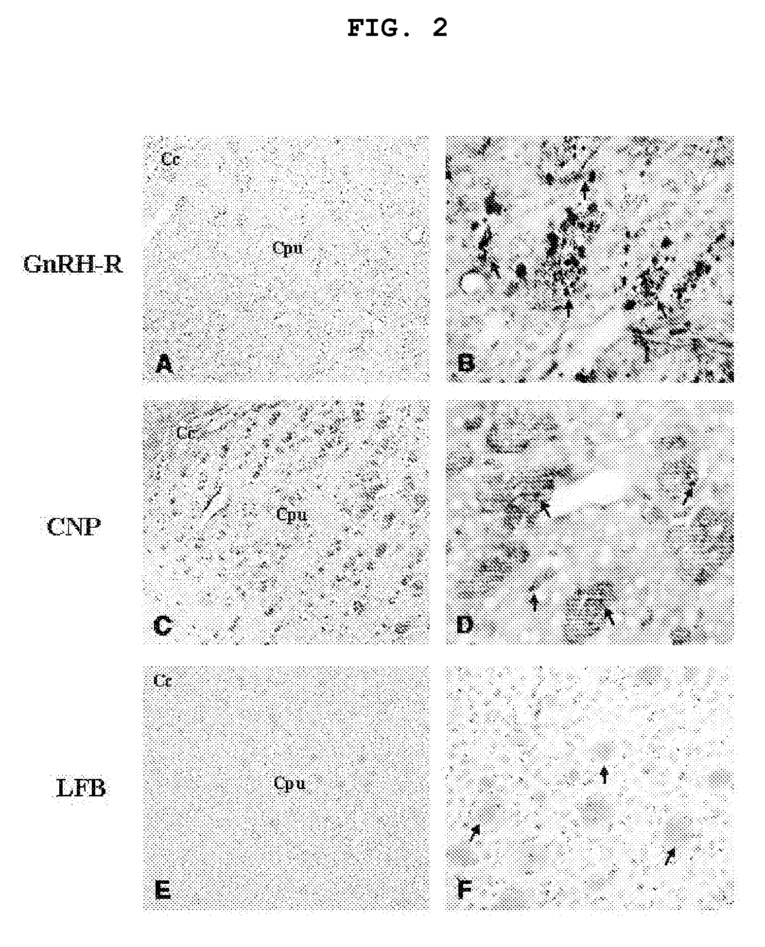 Method for searching myelin using gonadotropin-releasing hormone receptors as a new biomarker