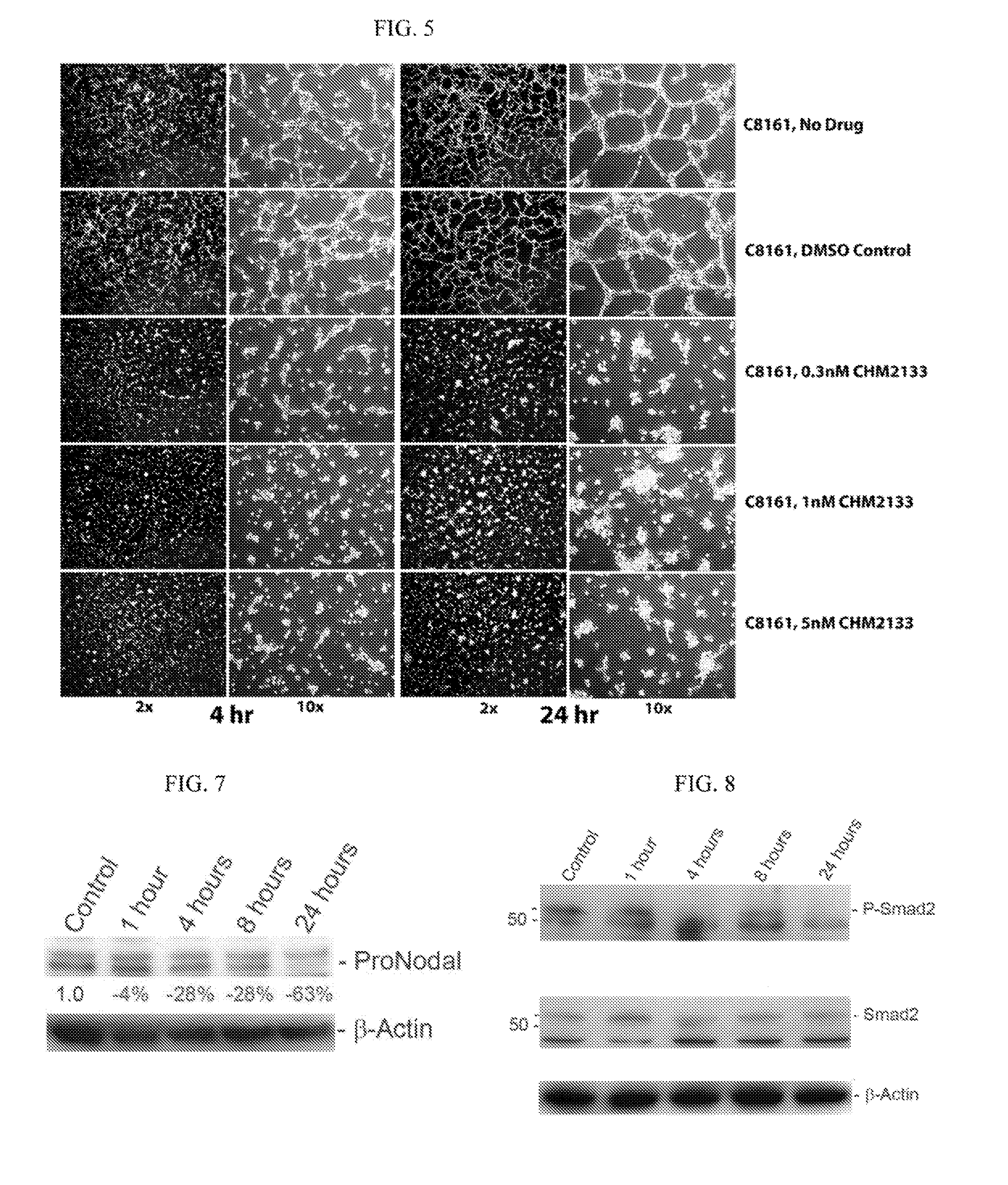 Novel use of aryl-quinolin derivatives as inhibitors of vasculogenic mimicry