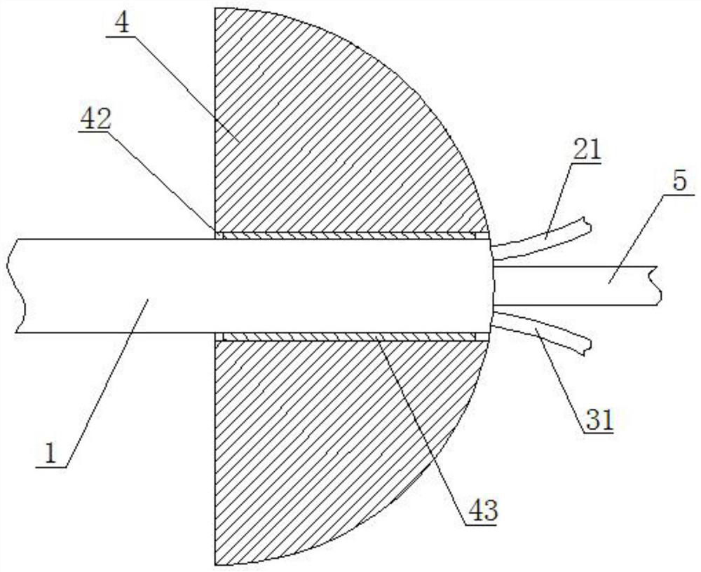 Novel gastroscope tube fixing device for gastroenterology department