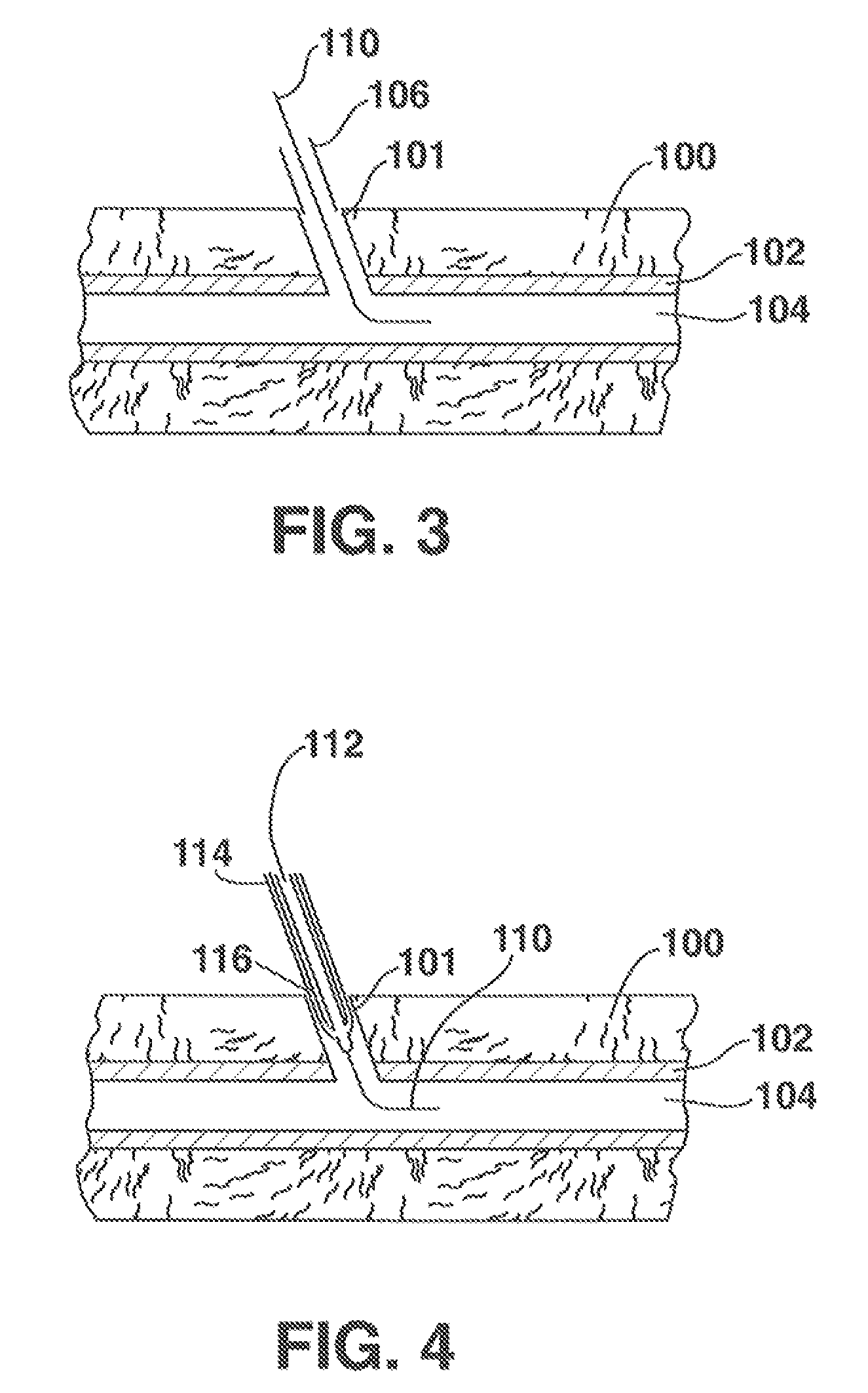 Low-profile vascular closure systems and methods of using same