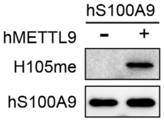 Specific histidine methylation modified S100A9 protein immunogen, polyclonal antibody and preparation method of polyclonal antibody