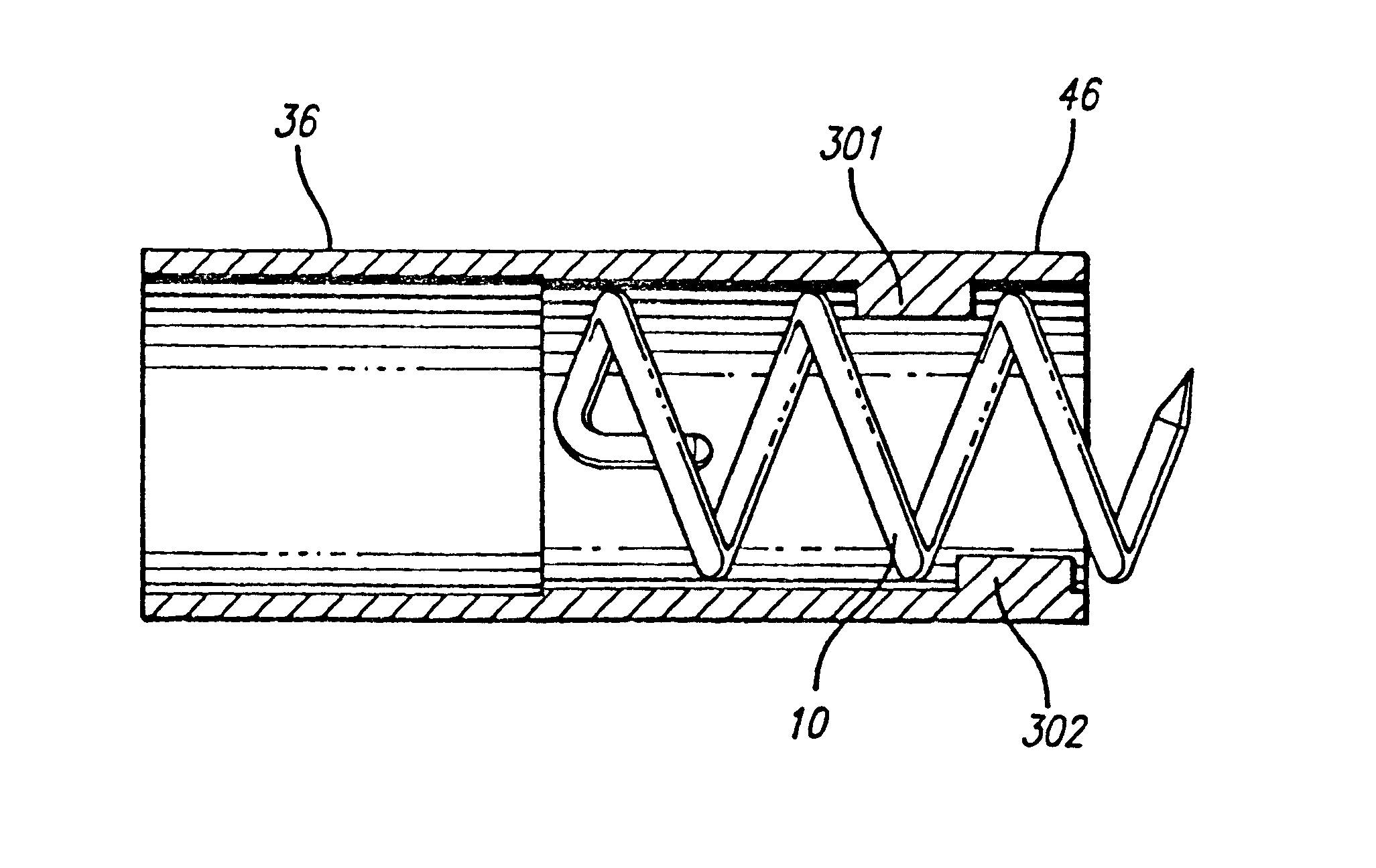 Surgical helical fastener with applicator