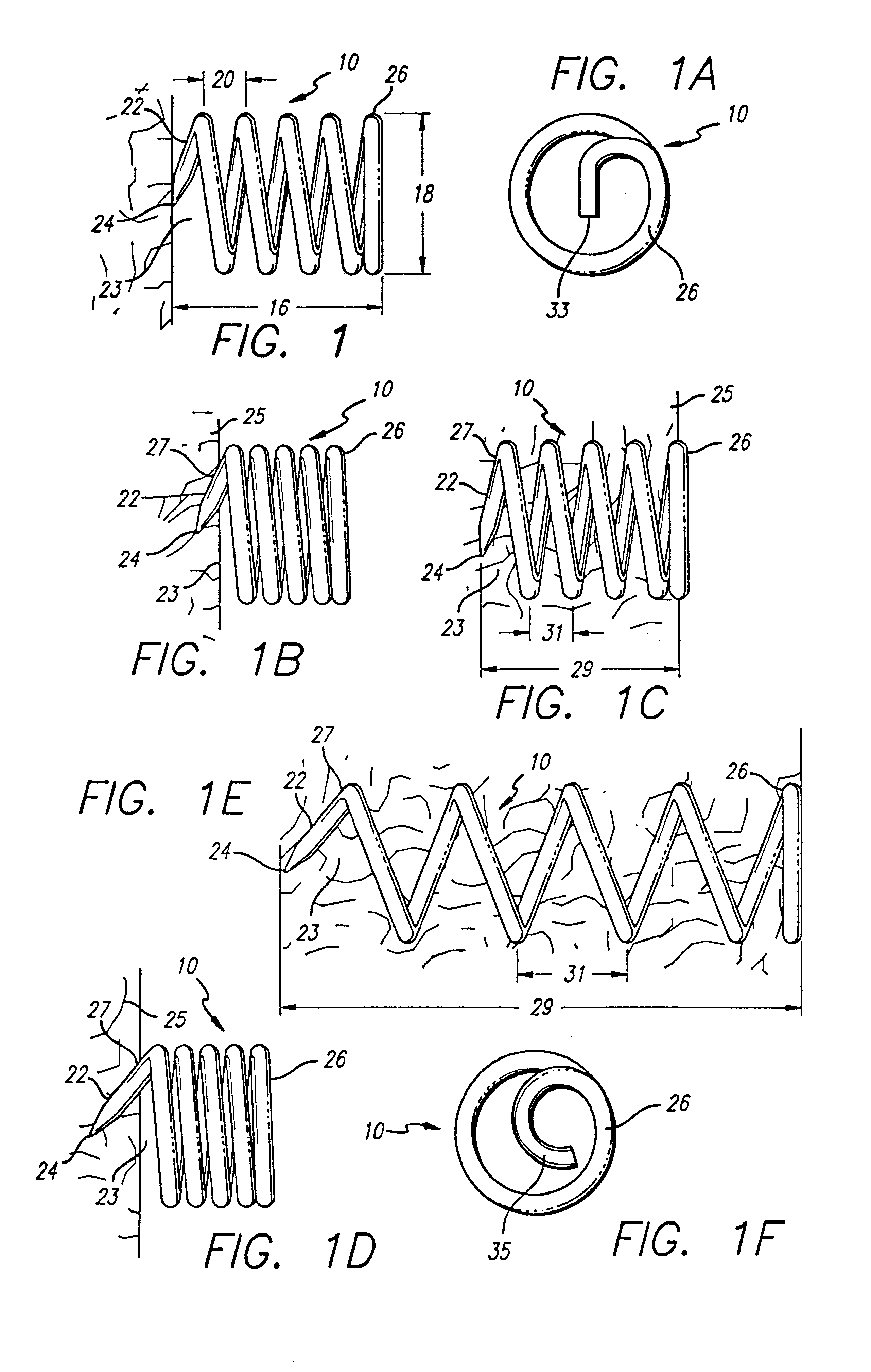 Surgical helical fastener with applicator