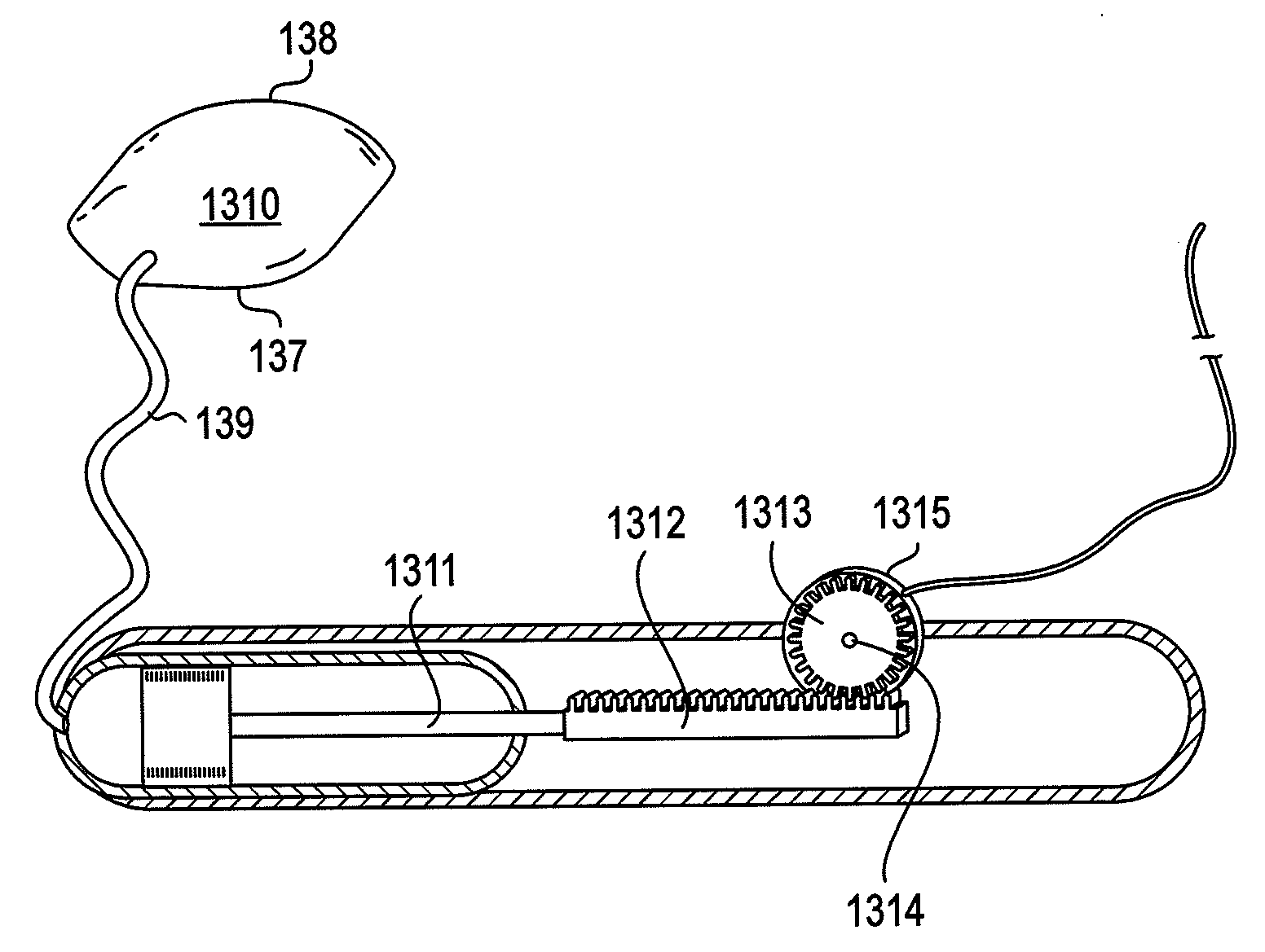 Devices, methods, and systems for harvesting energy in the body