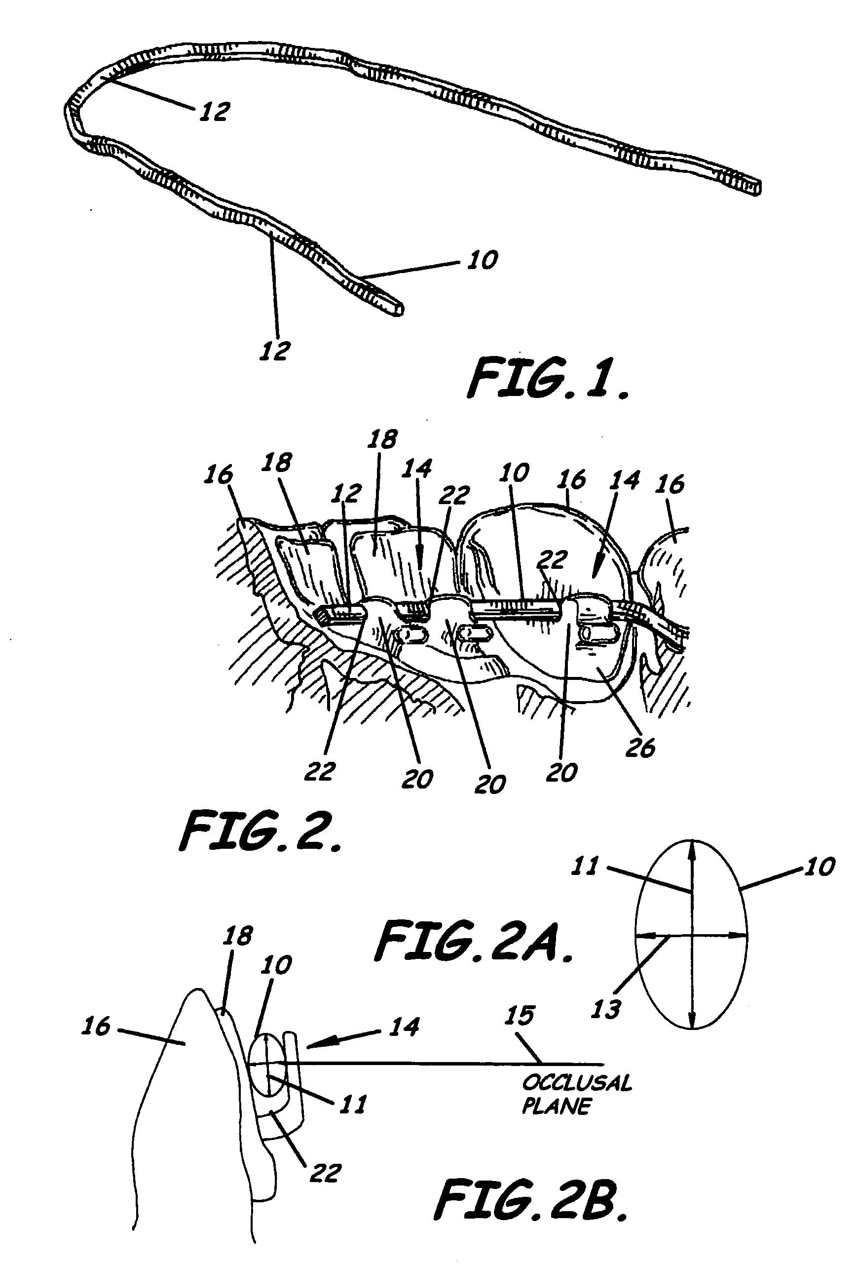 Modular system for customized orthodontic appliances