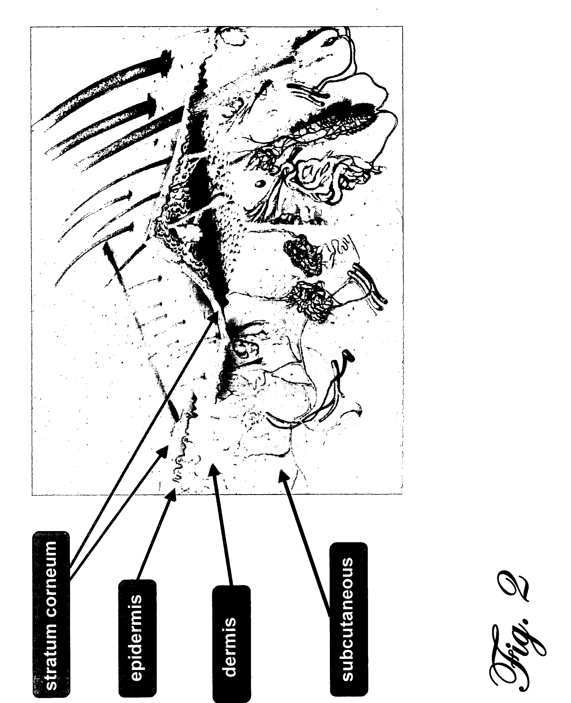 Apparatus and method for controlling operation of vehicles or machinery by intoxicated or impaired individuals