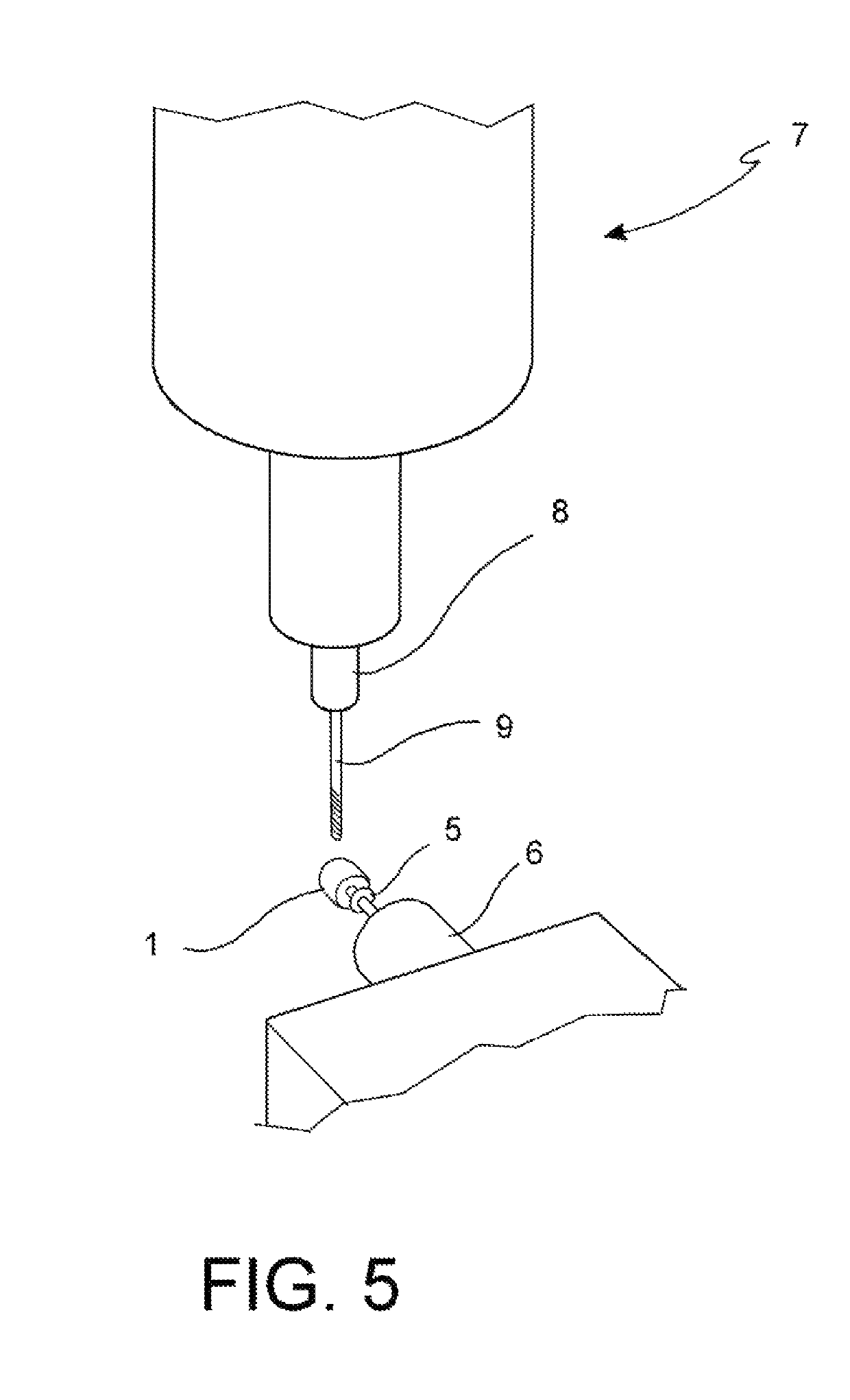 Method for manufacturing a dental prosthesis