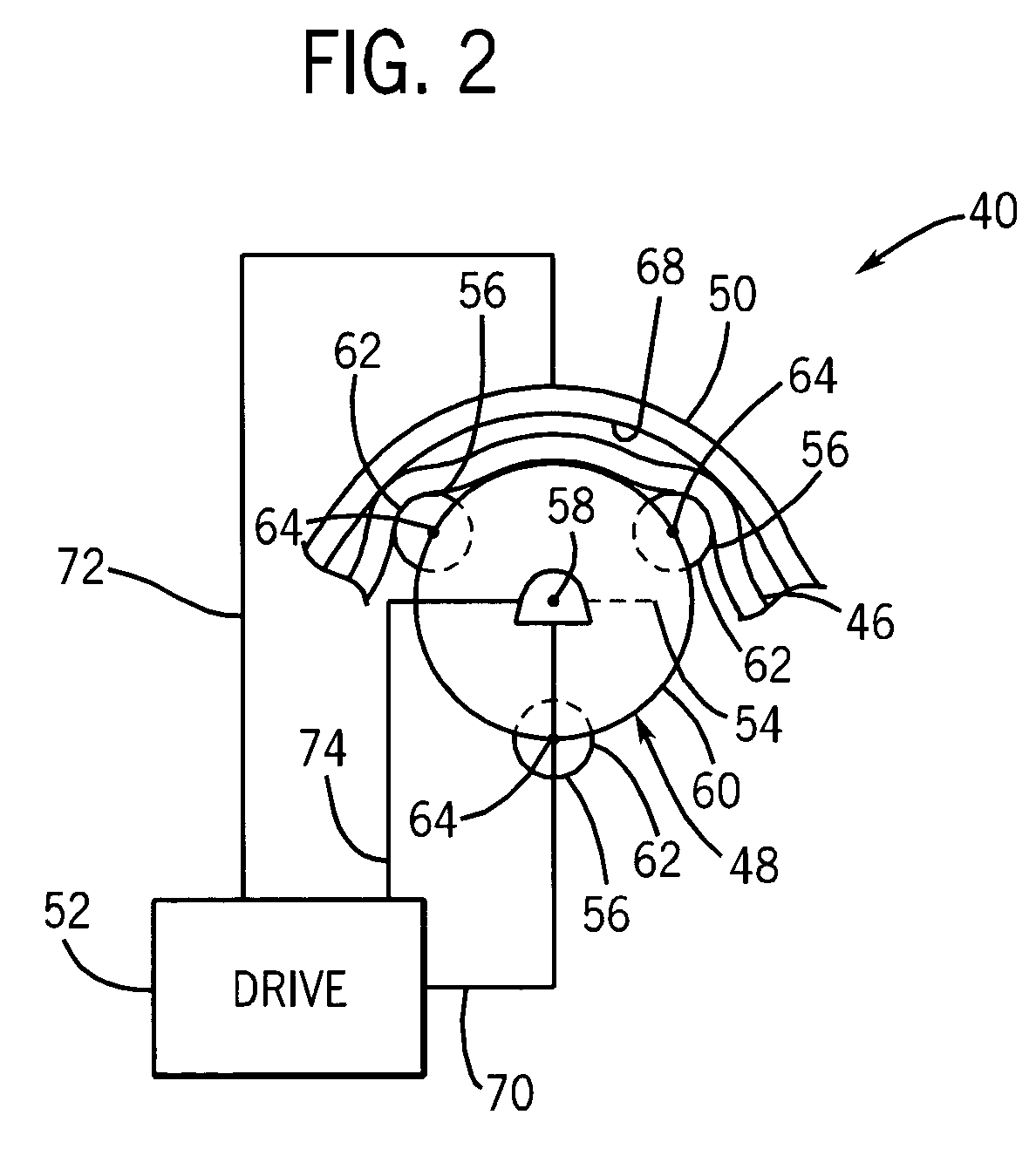 Peristaltic pump