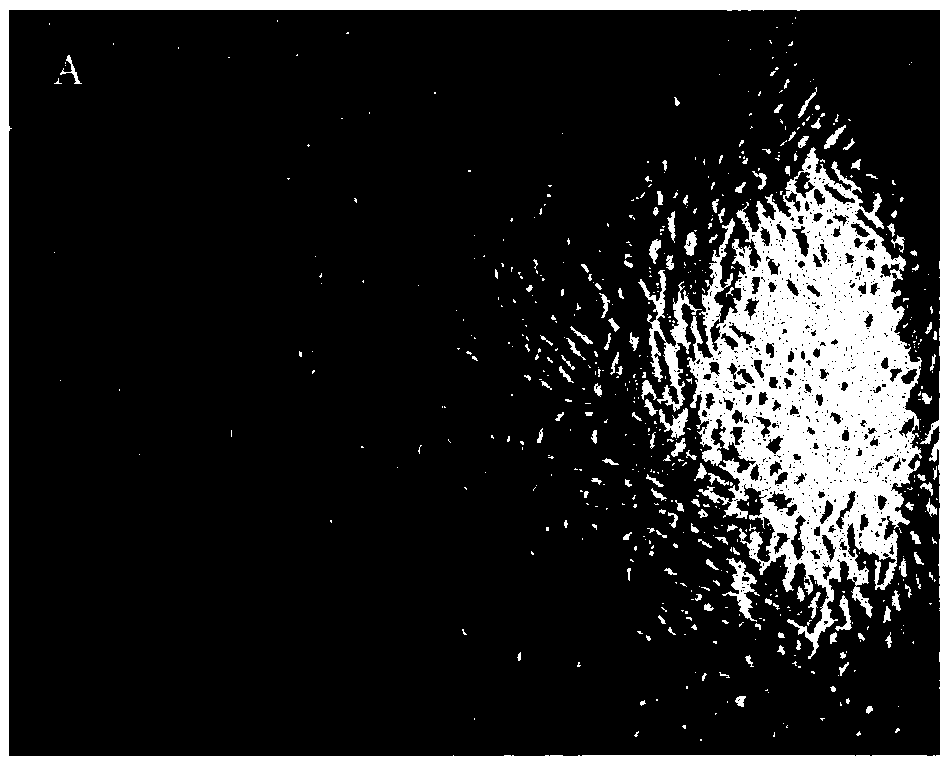 Stem cell preserving fluid used for transplantation of mesenchymal stem cells