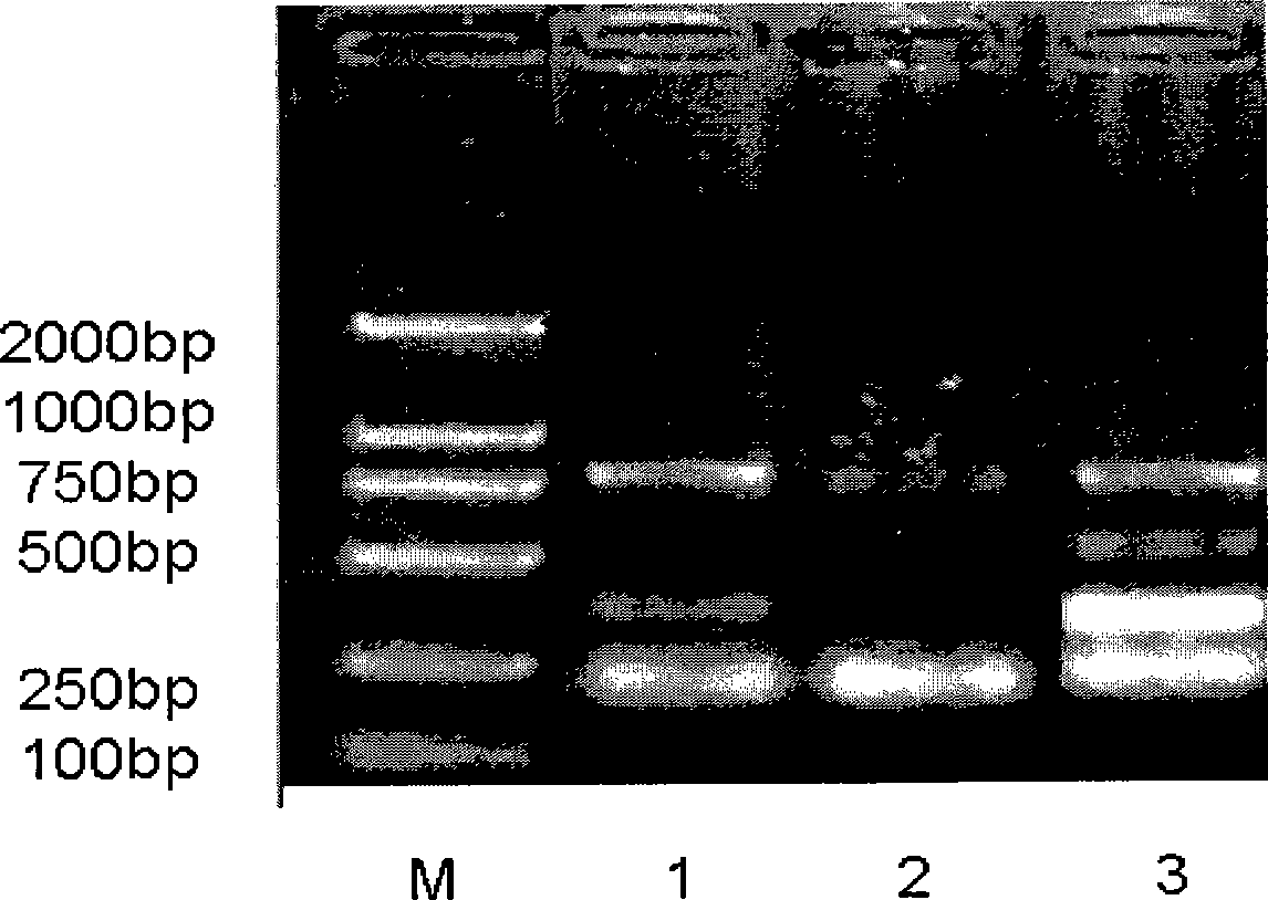 Multiple PCR fast detecting method for oral cavity pathogen