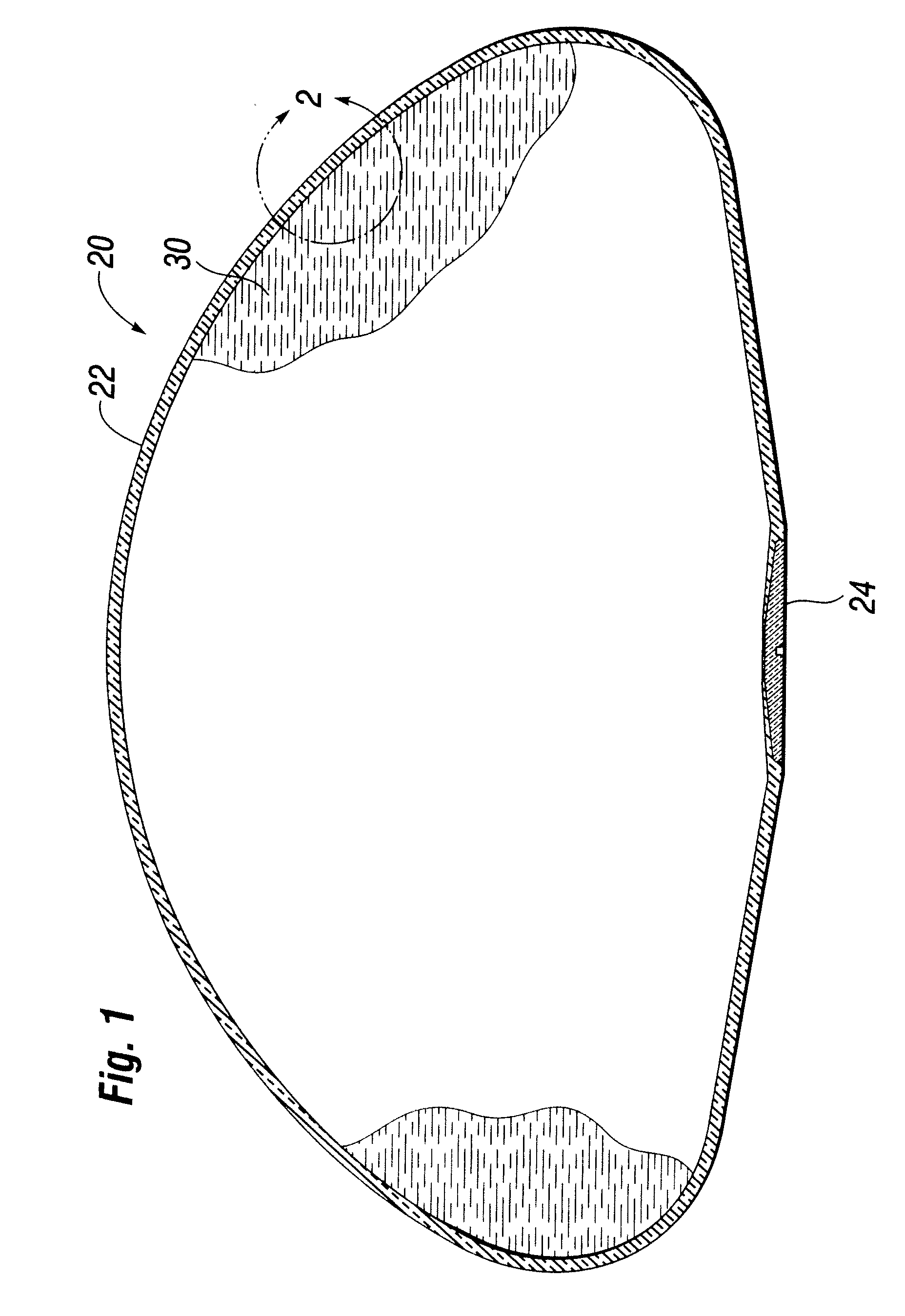 Self-sealing shell for inflatable prostheses