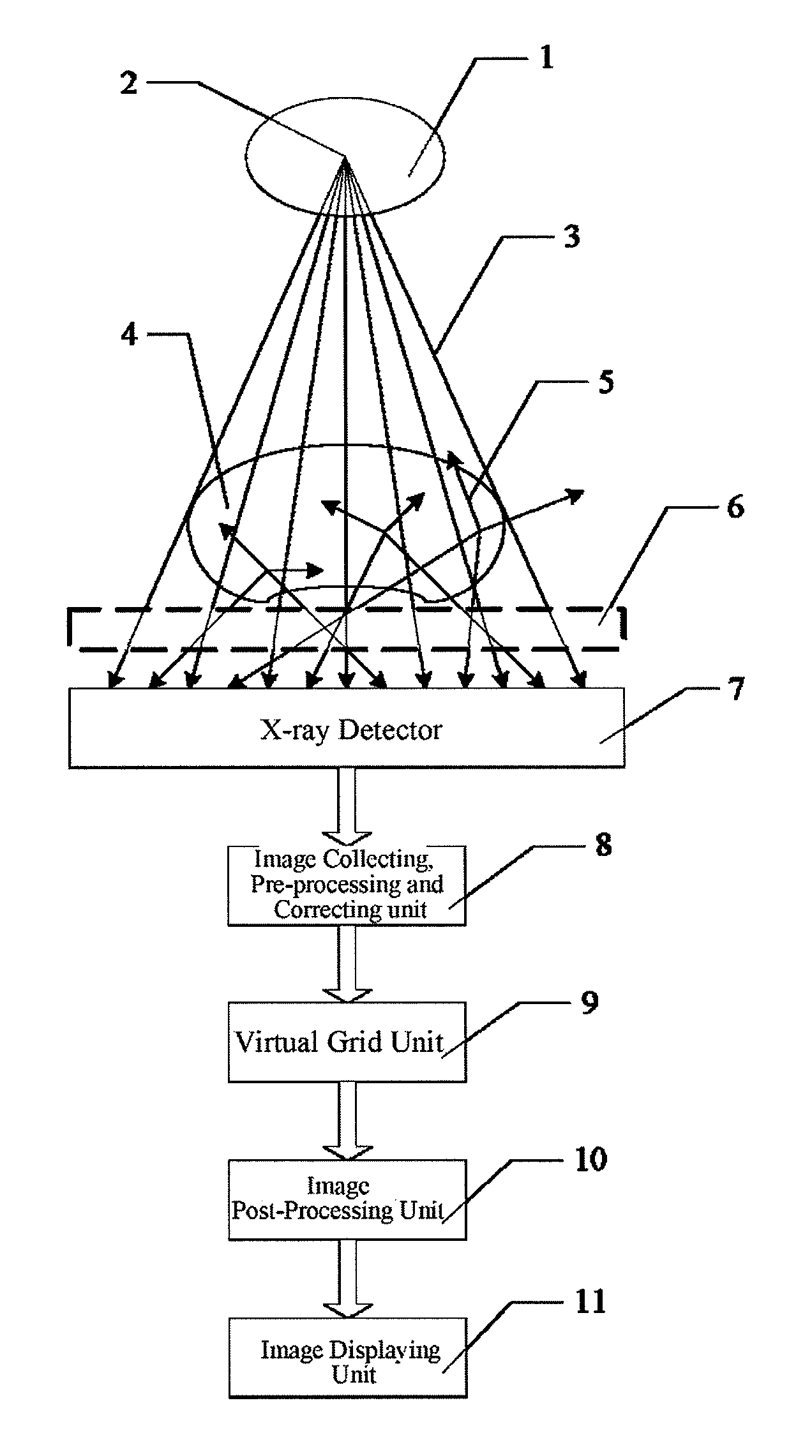 Virtual grid imaging method and system for eliminating scattered radiation effect