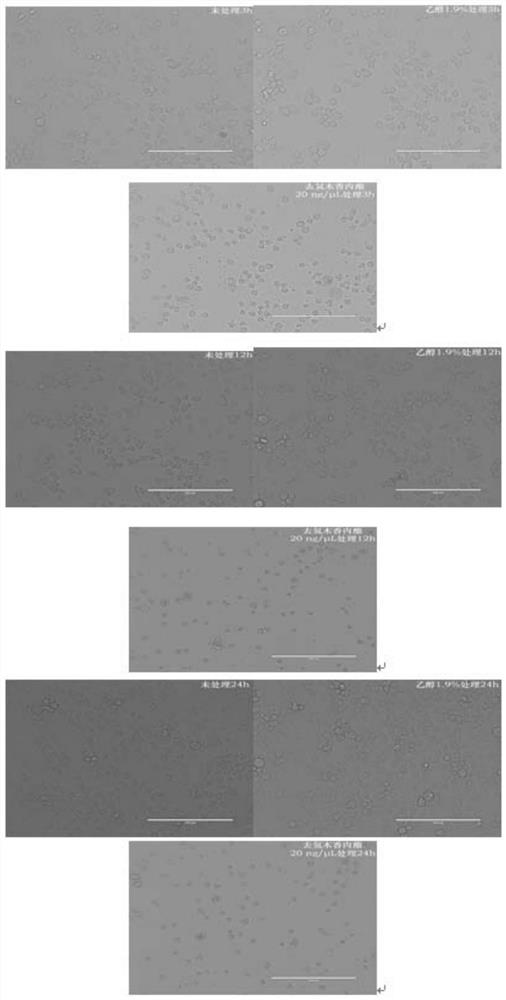 Bioactivity of dehydrocostus lactone on spodoptera frugiperda and application of dehydrocostus lactone in agricultural control