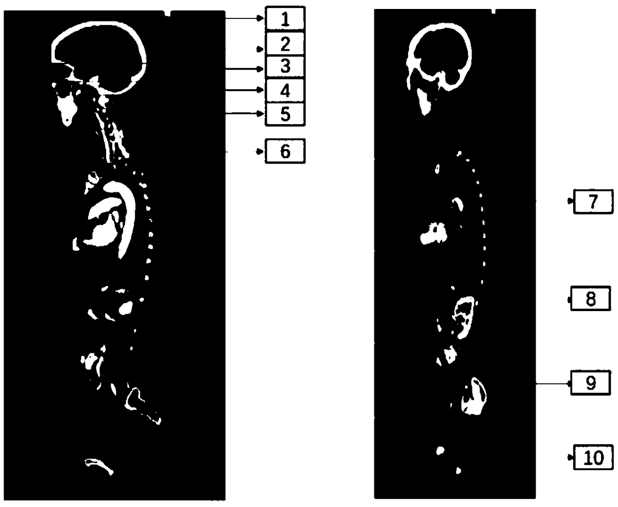 A method for segmenting human organs in medical images based on a neural network