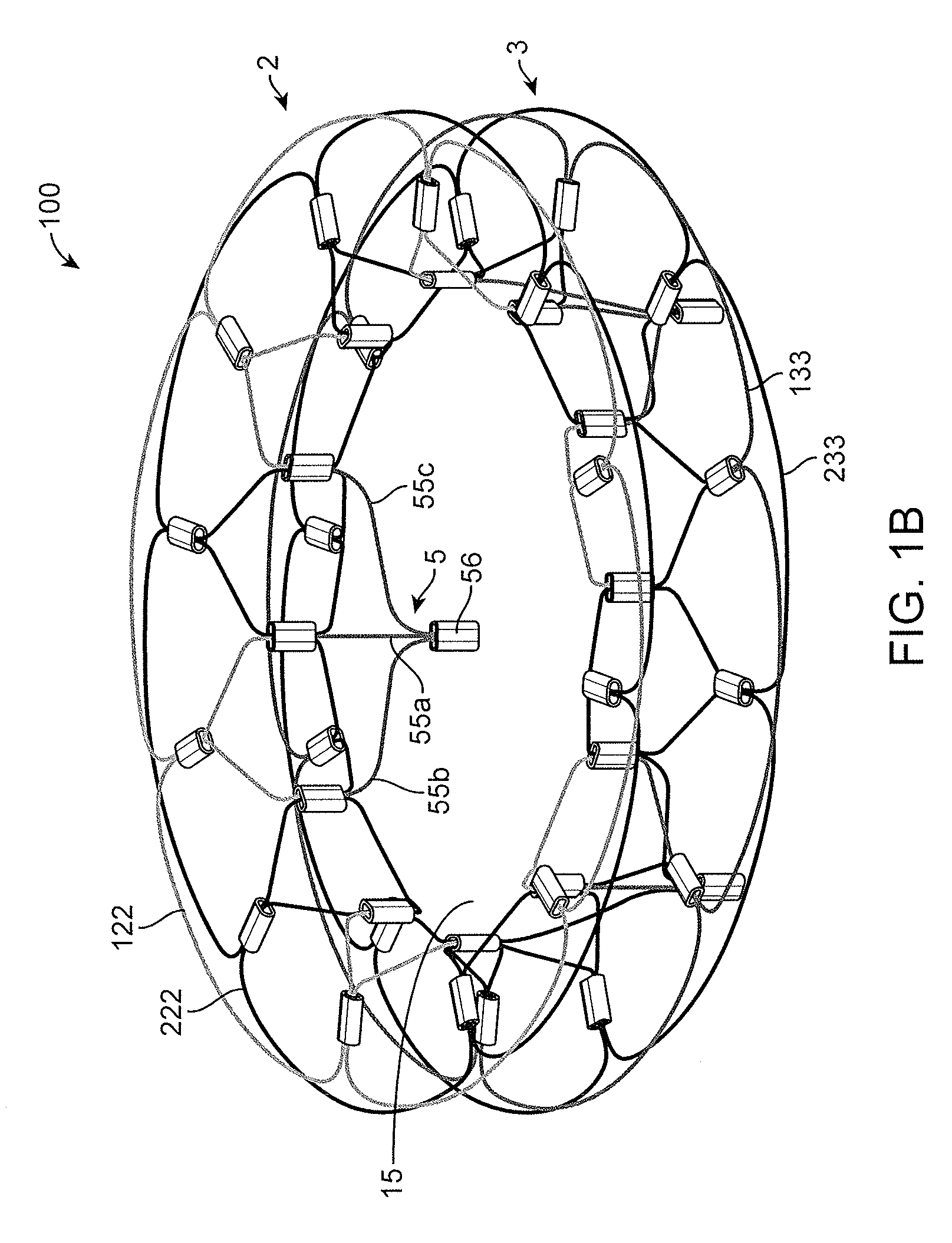 System and method for cardiac valve repair and replacement