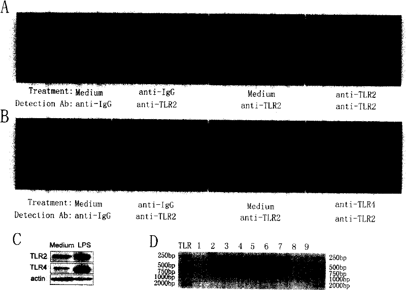 Anti Toll-like receptor 2 antibody inhibiting tumor metastasis use