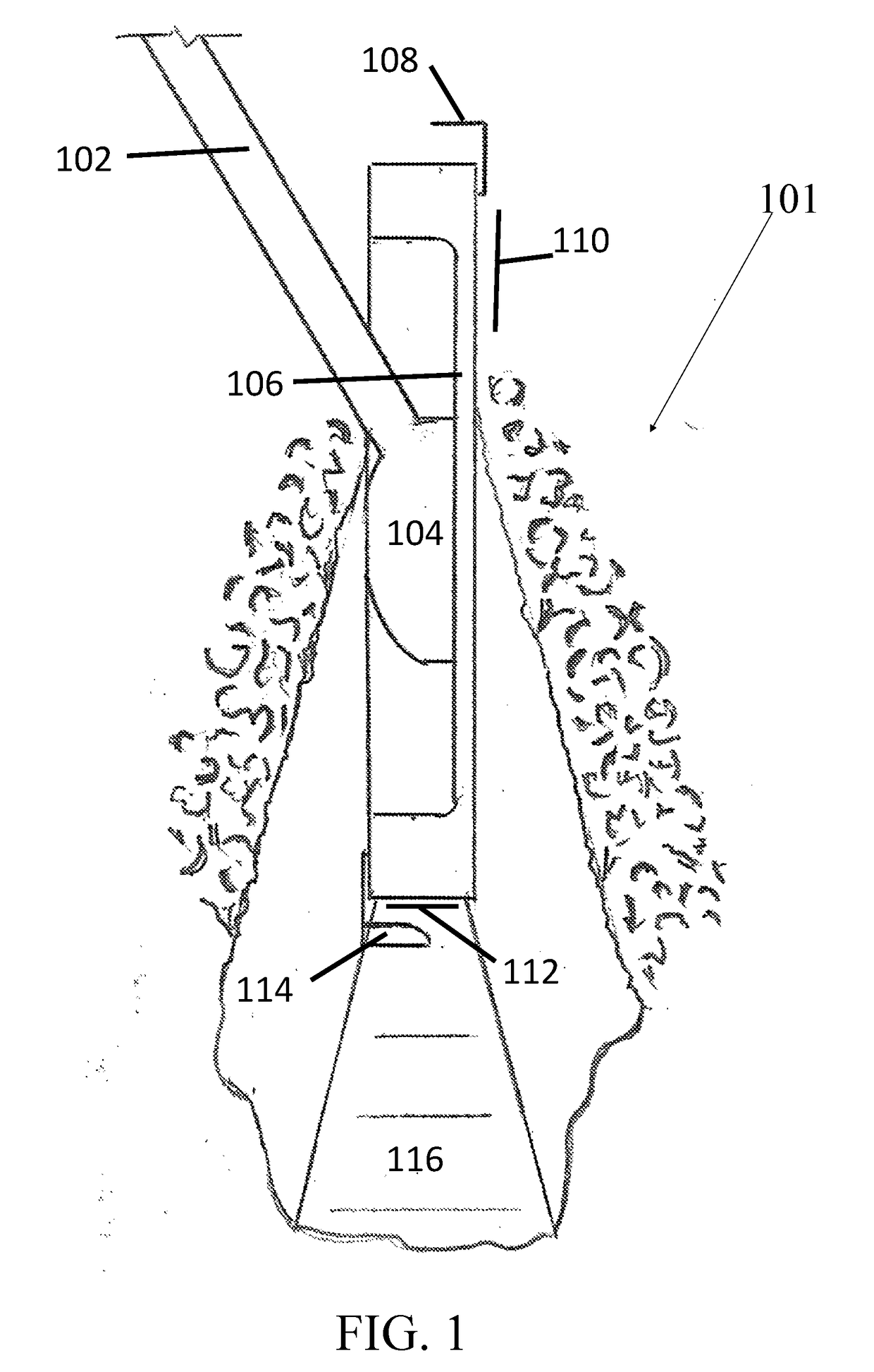 Vehicle-Attached Excavation Implement